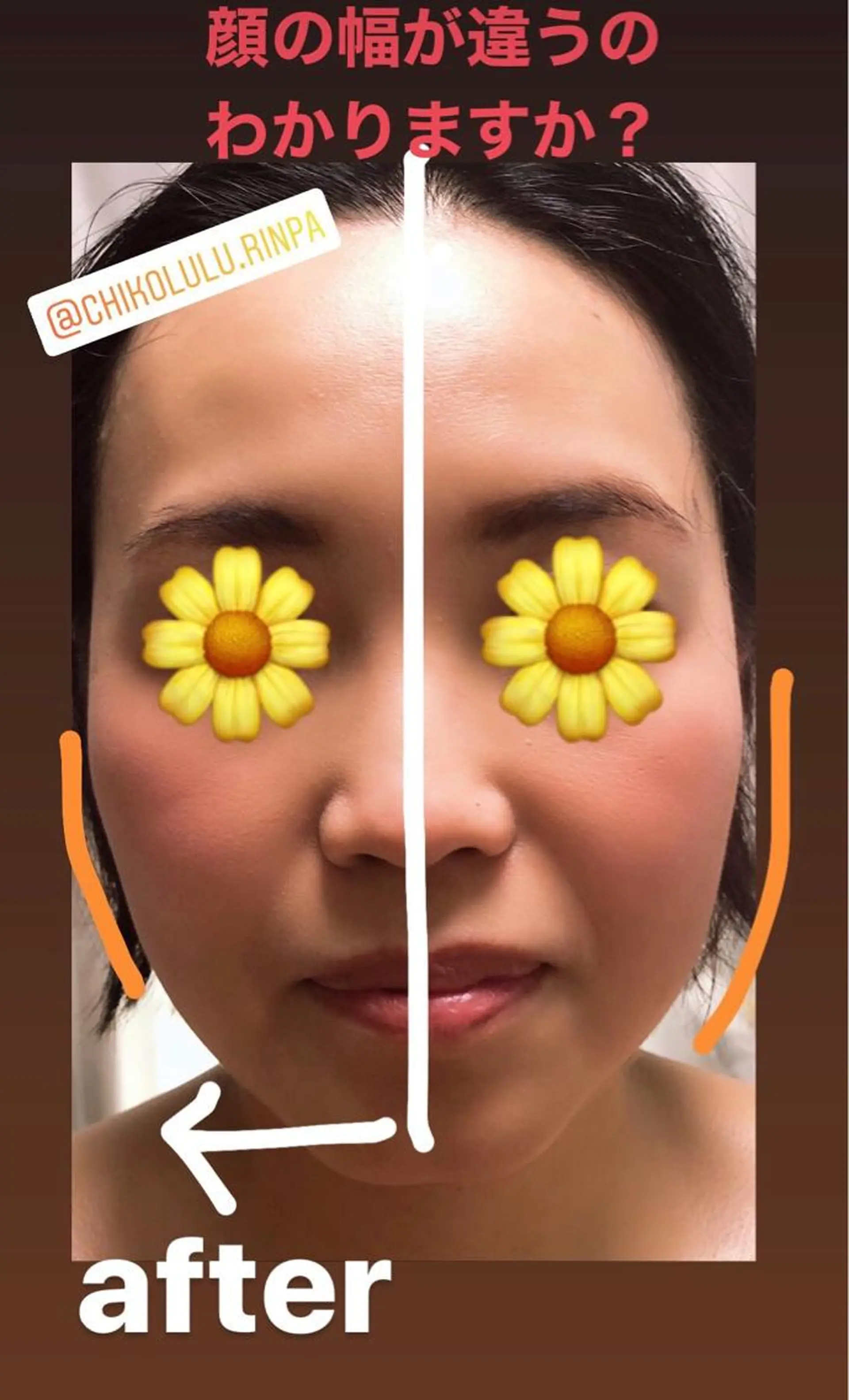 chikolulu サロンチコルルのエステ・リラクイメージ