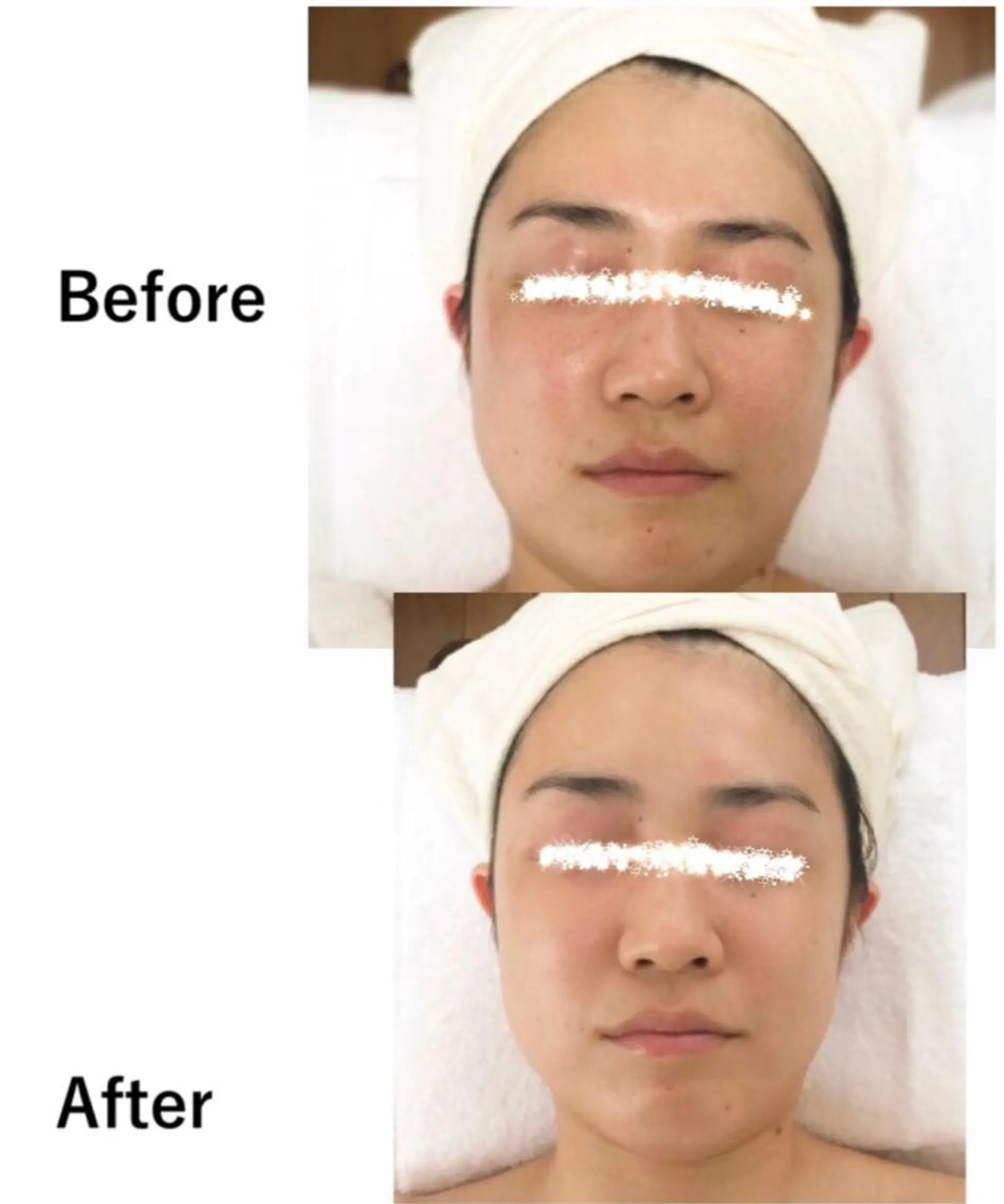 RENsalon大阪 体質改善リトリートのエステ・リラクイメージ