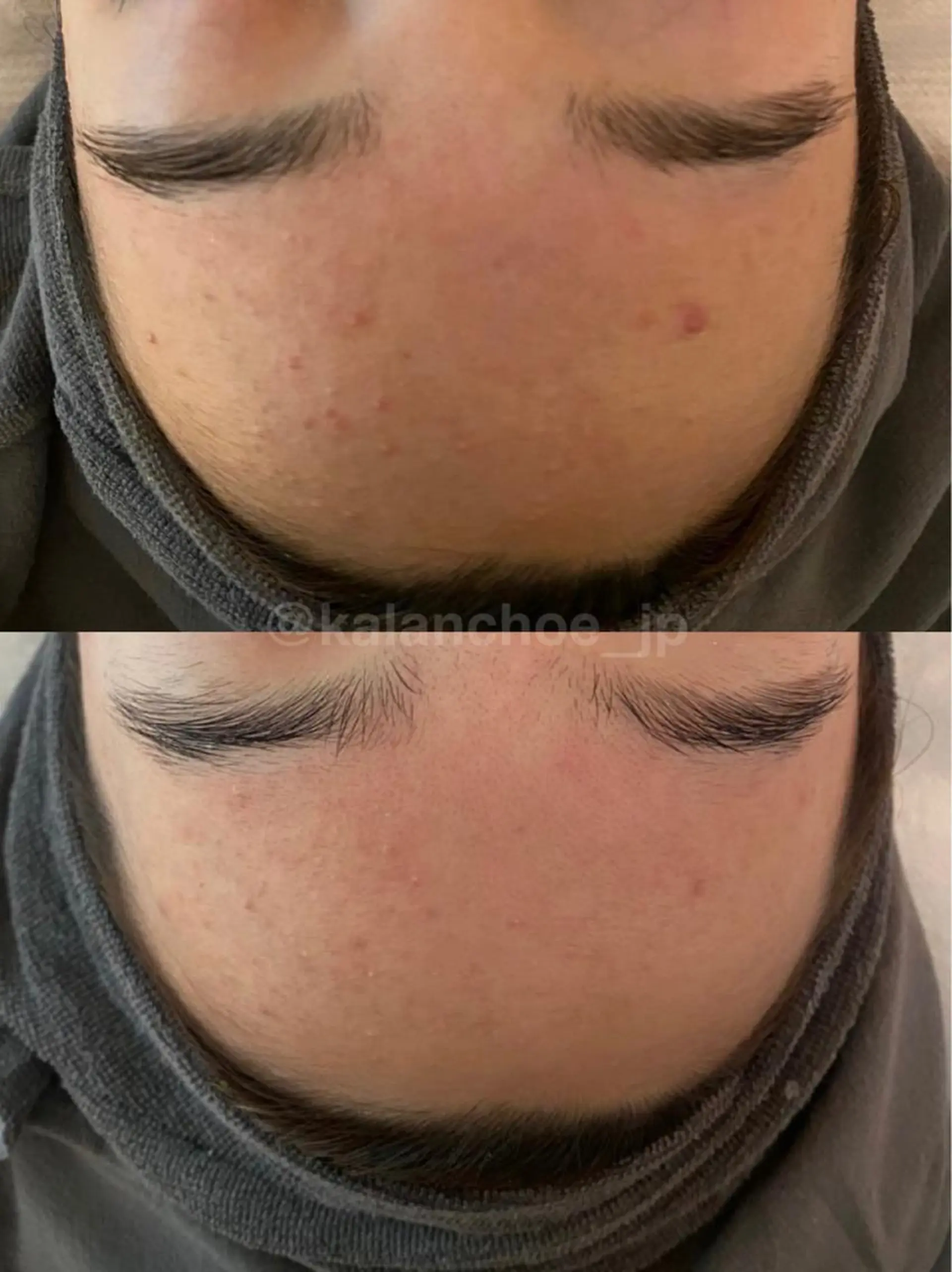 エステ 肌質改善 KALANCHOEのエステ・リラクイメージ