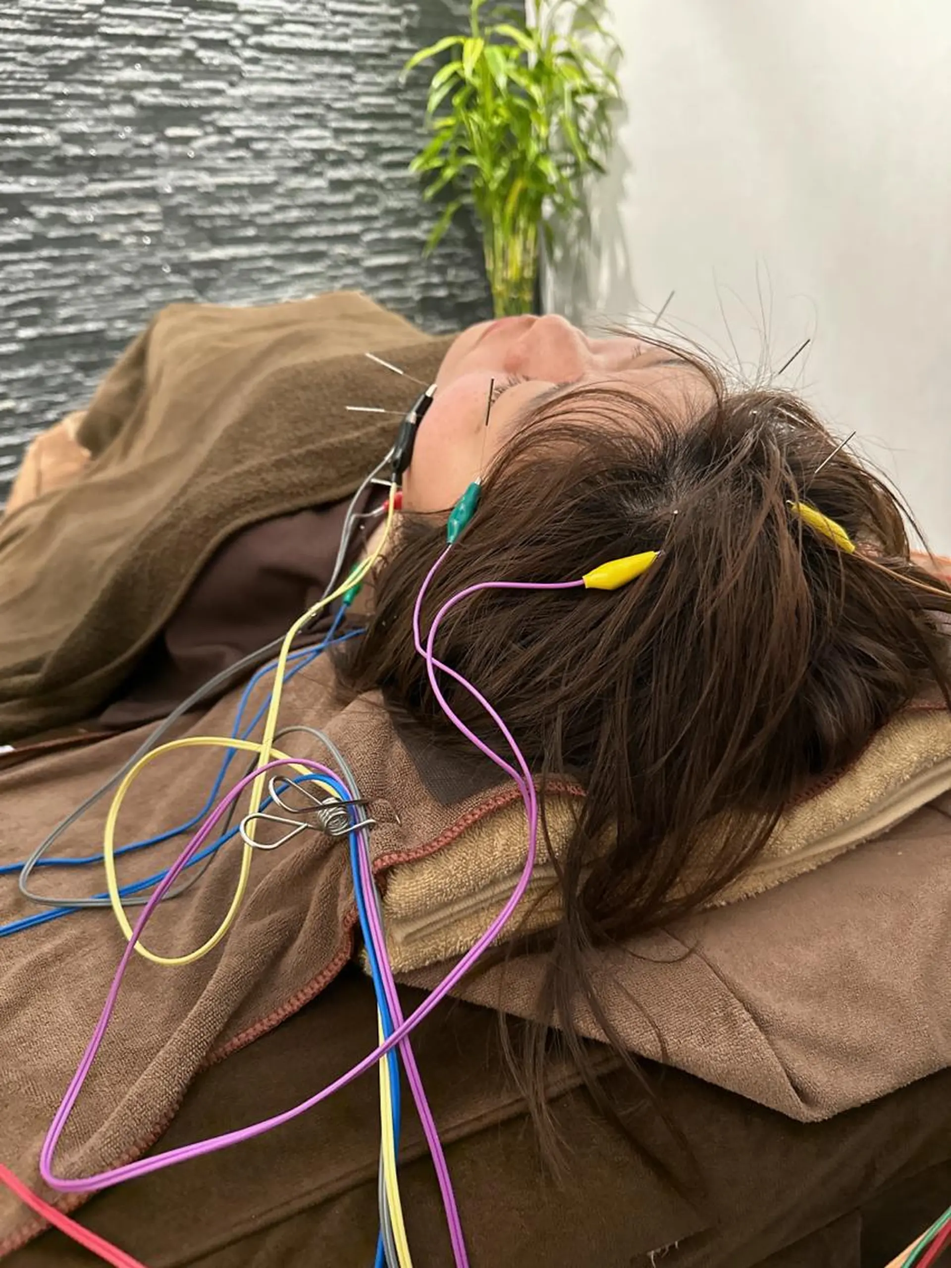 その他 美容鍼灸整体サロンBeauJu所属・小顔矯/美容鍼/鍼灸 BeauJuのその他イメージ