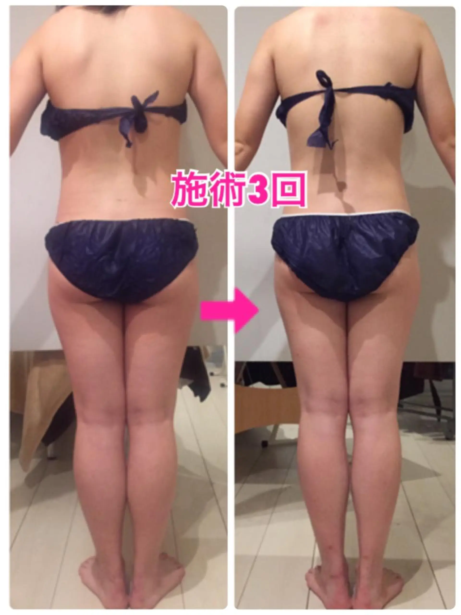 ショート カラー パーマ ヘアアレンジ メンズ キッズ ネイル マツエク・マツパ ‍痩身＆ボディ 結果出し🌟丹野のエステ・リラクイメージ