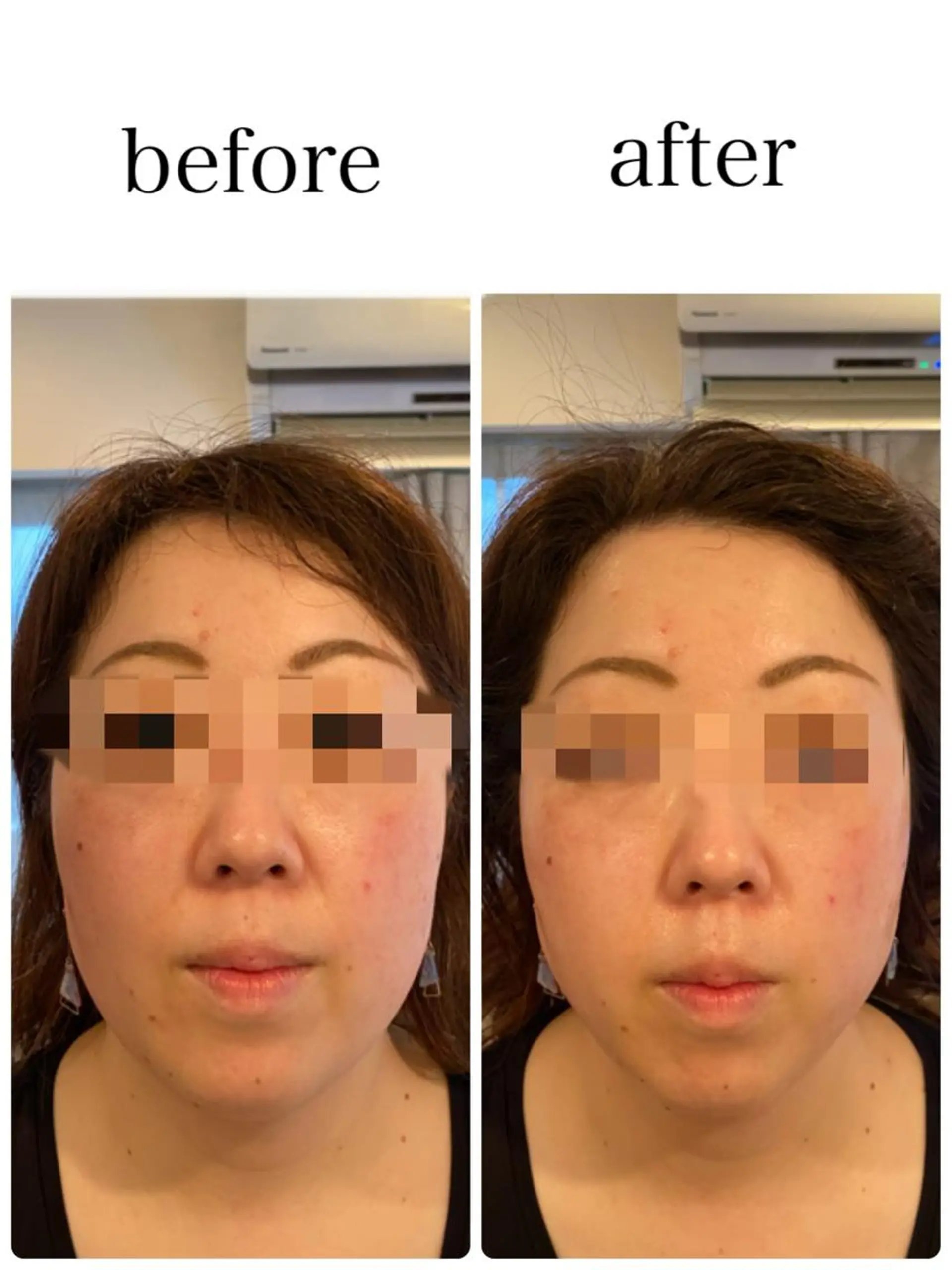 エステ 姿勢改善&beauty salon LAUB所属・姿勢改善 サロンLAUB奥村のエステ・リラクイメージ