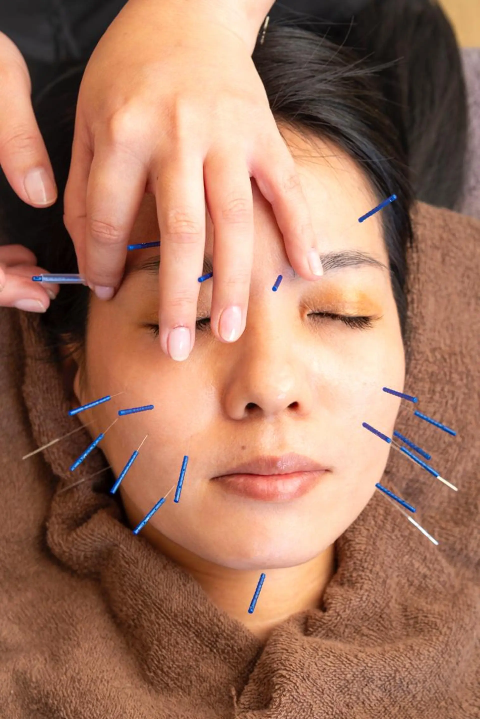 鍼処　木蓮所属・小顔美肌クリエーター 鍼処木蓮のエステ・リラクイメージ