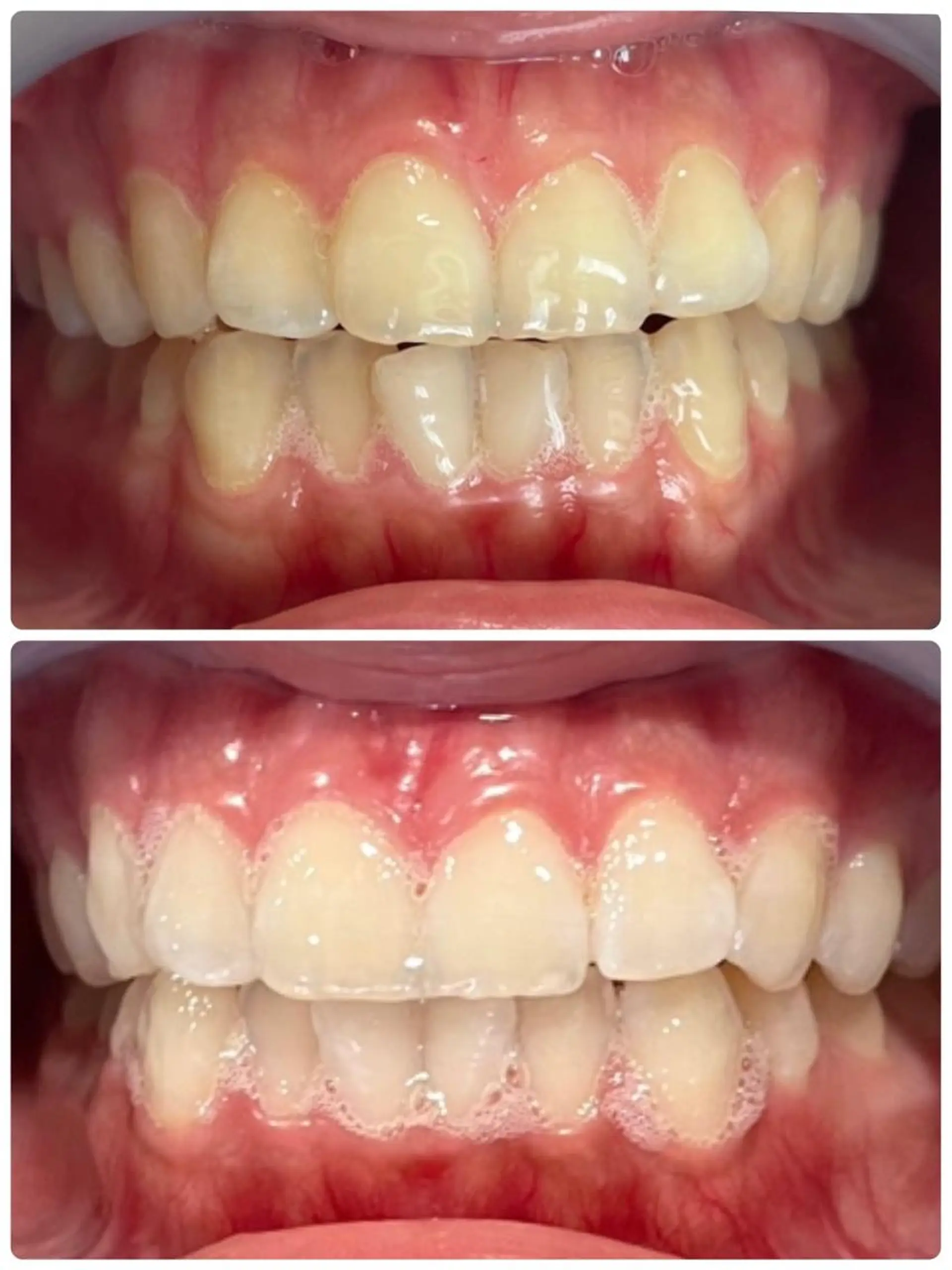 その他 LOVE ホワイトニング下北沢のエステ・リラクイメージ