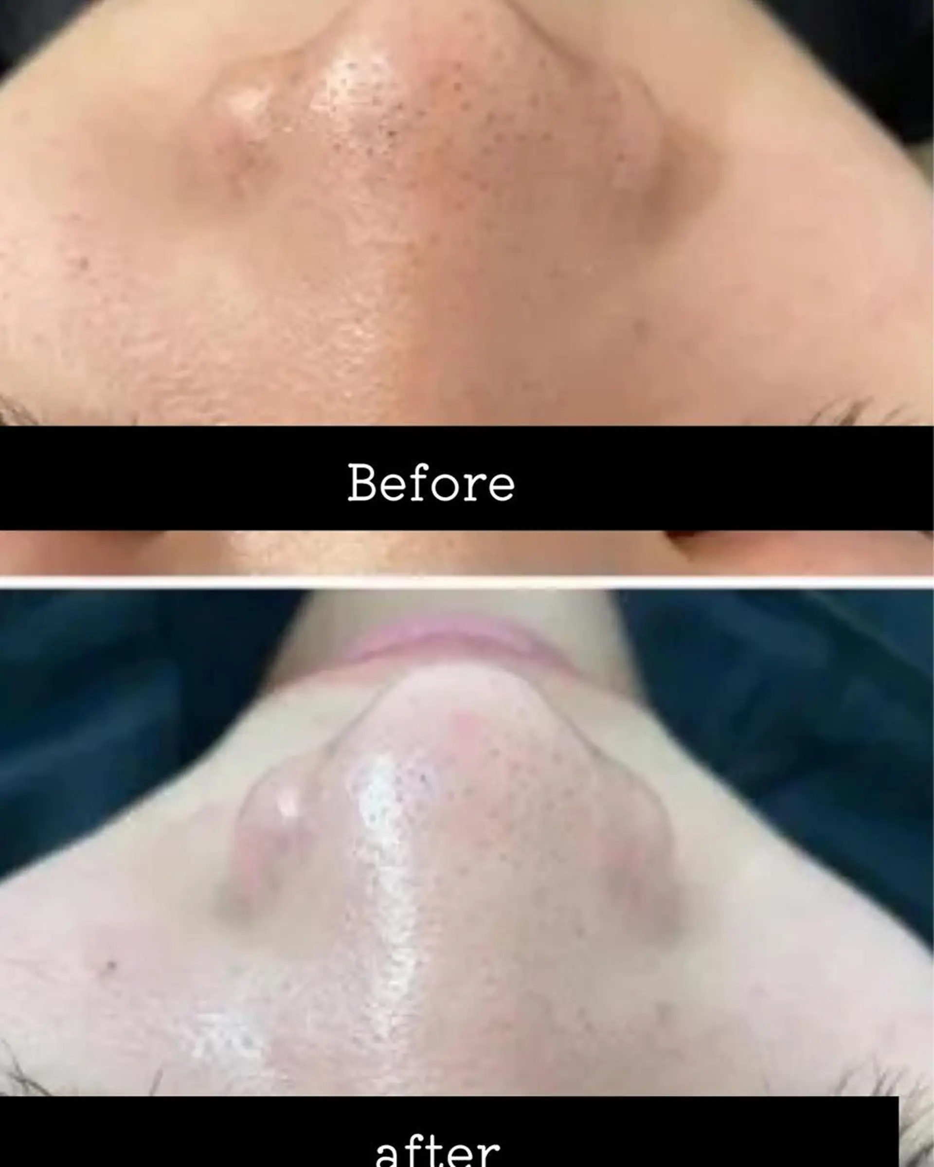 エステ É LINDA所属・E LINDAのネイルデザイン