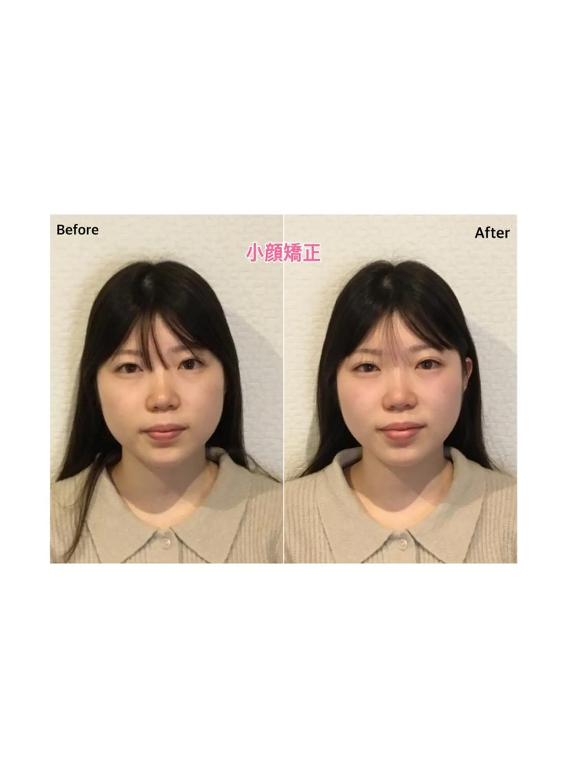 チキバン美容鍼灸整体 サロン心斎橋店のエステ・リラクイメージ