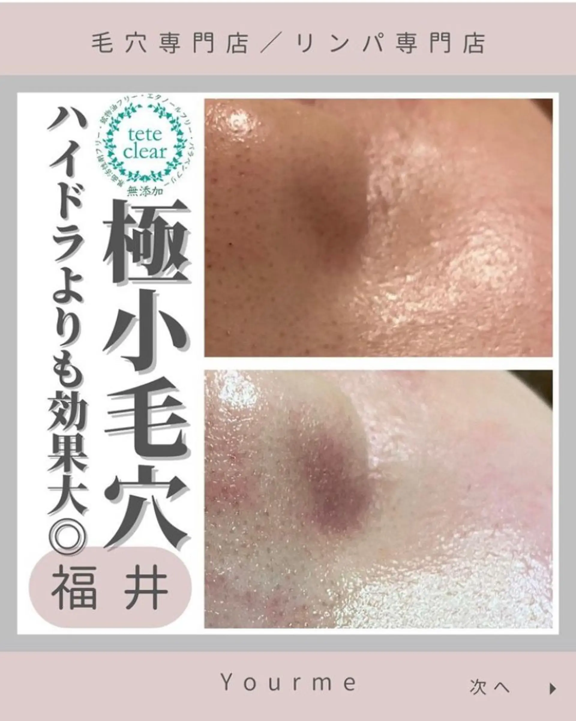 毛穴肌質ケアサロン Yourmeユアミーのエステ・リラクイメージ