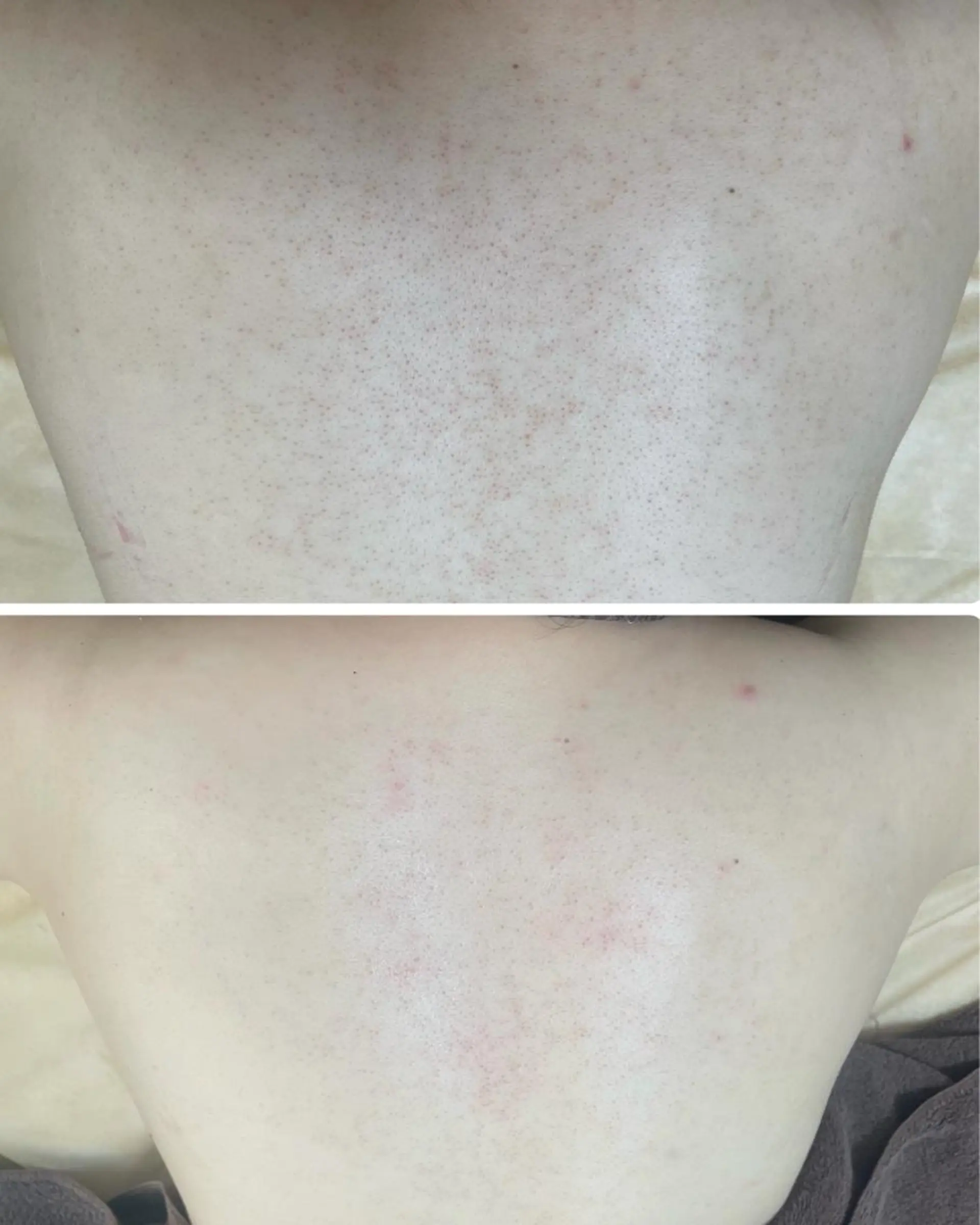 肌質改善サロン La Divinaのエステ・リラクイメージ