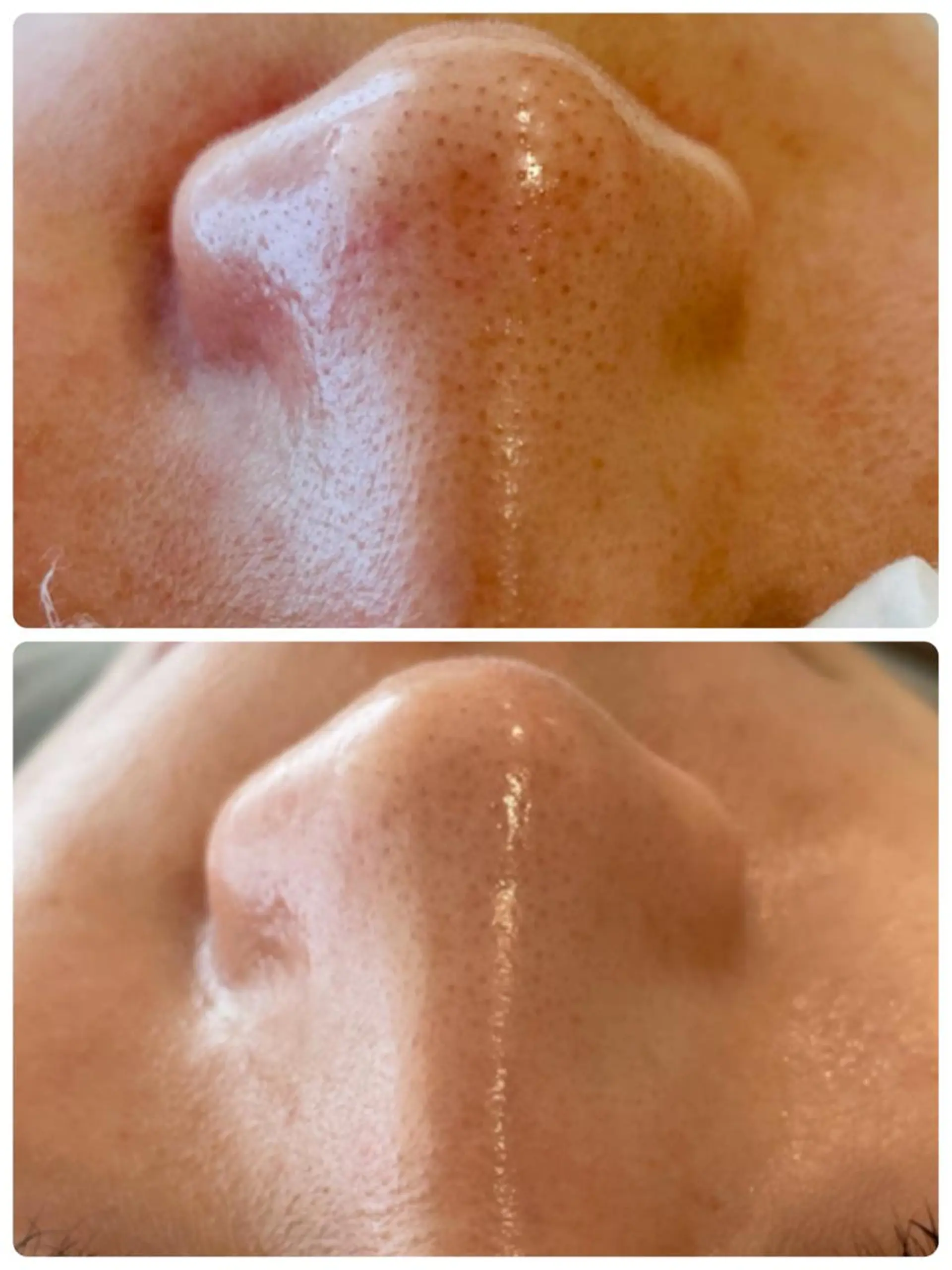 エステ フェイシャル専門 肌質改善/プランスのエステ・リラクイメージ