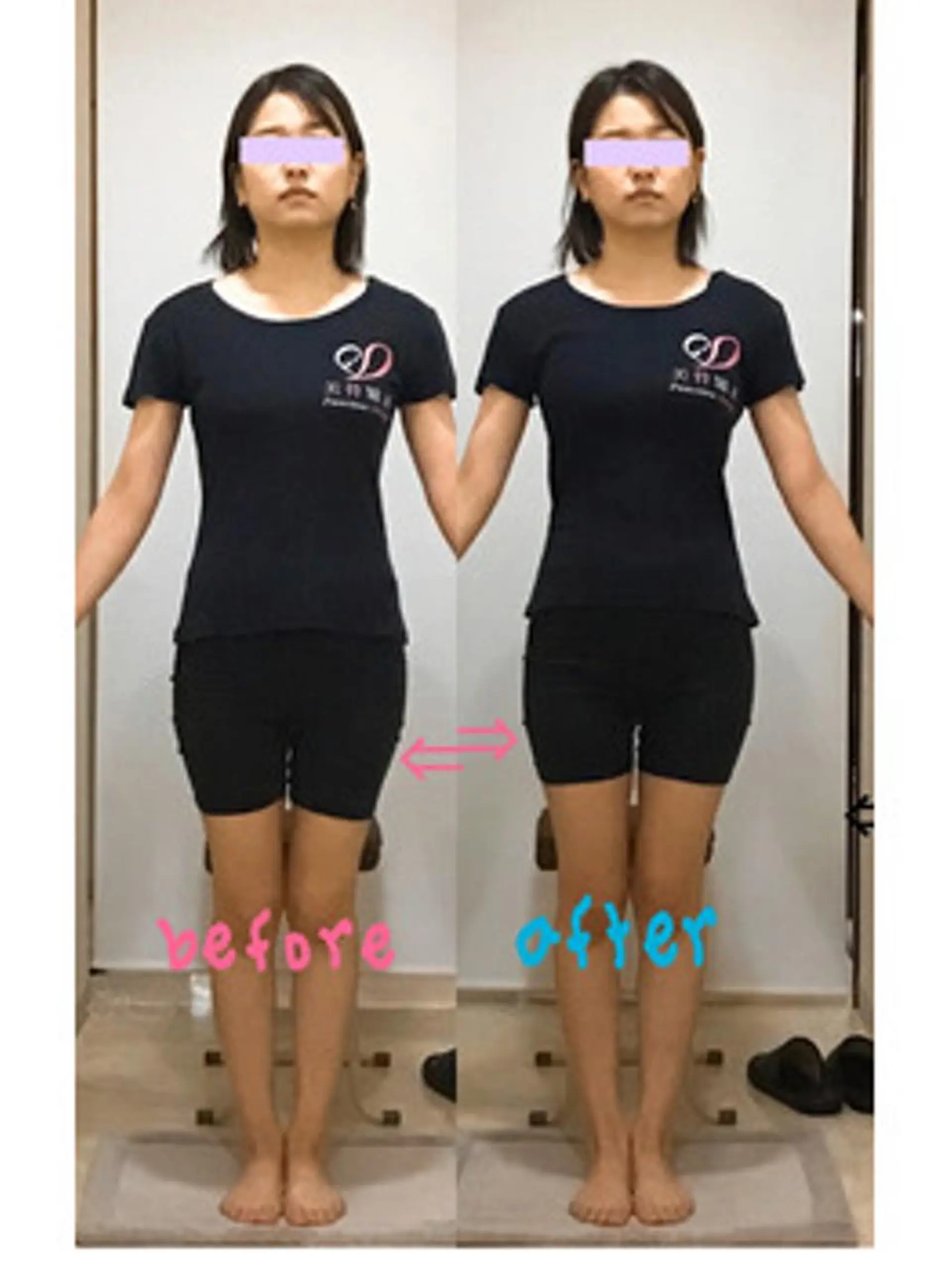 姿勢・骨盤/小顔矯正 痩身ダイエット 横田のエステ・リラクイメージ