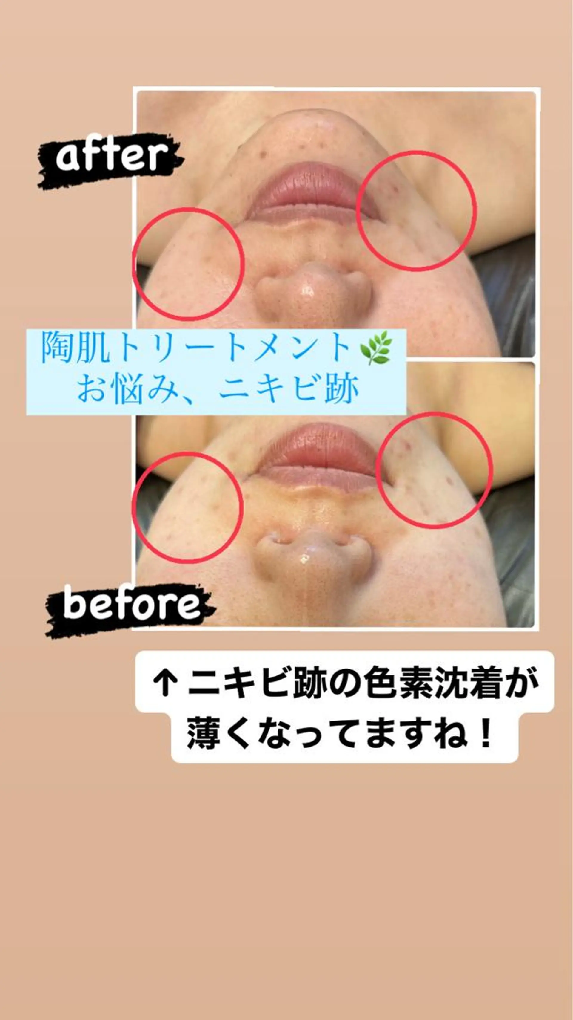 喜山 あつこのエステ・リラクイメージ