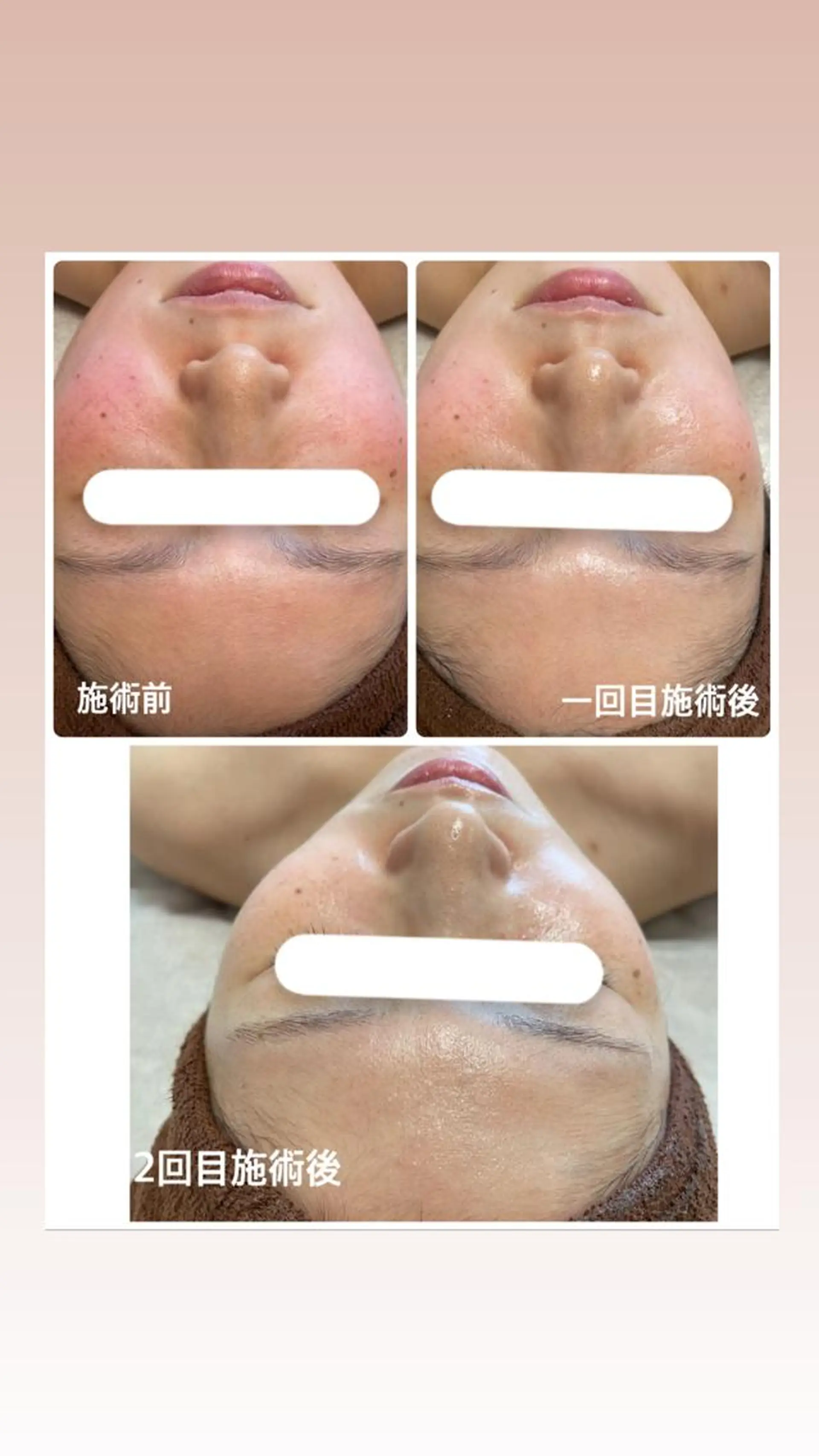 エステ リラク ビューティーサロン Claireのエステ・リラクイメージ