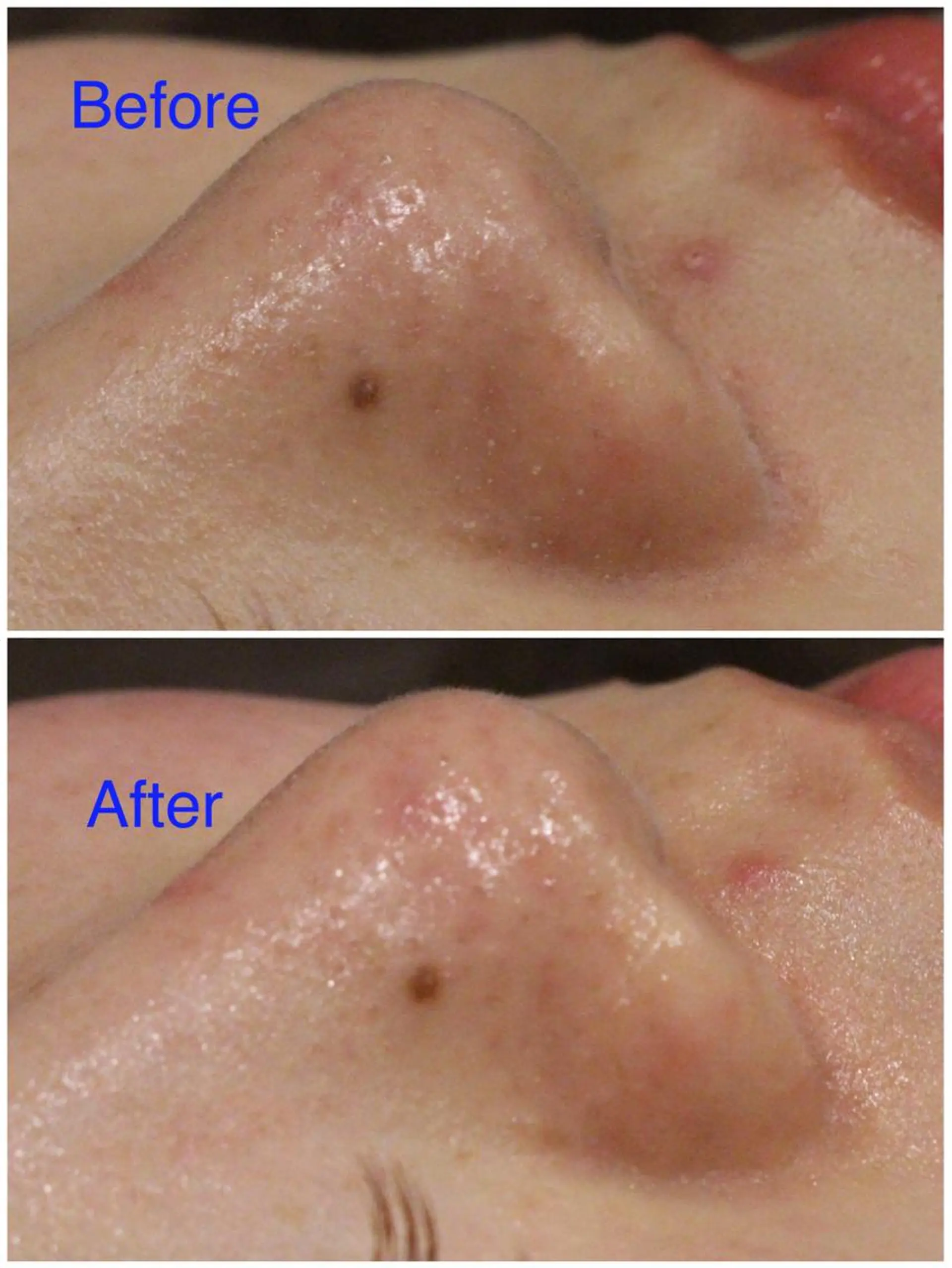 ANRIRE (アンリール)のエステ・リラクイメージ