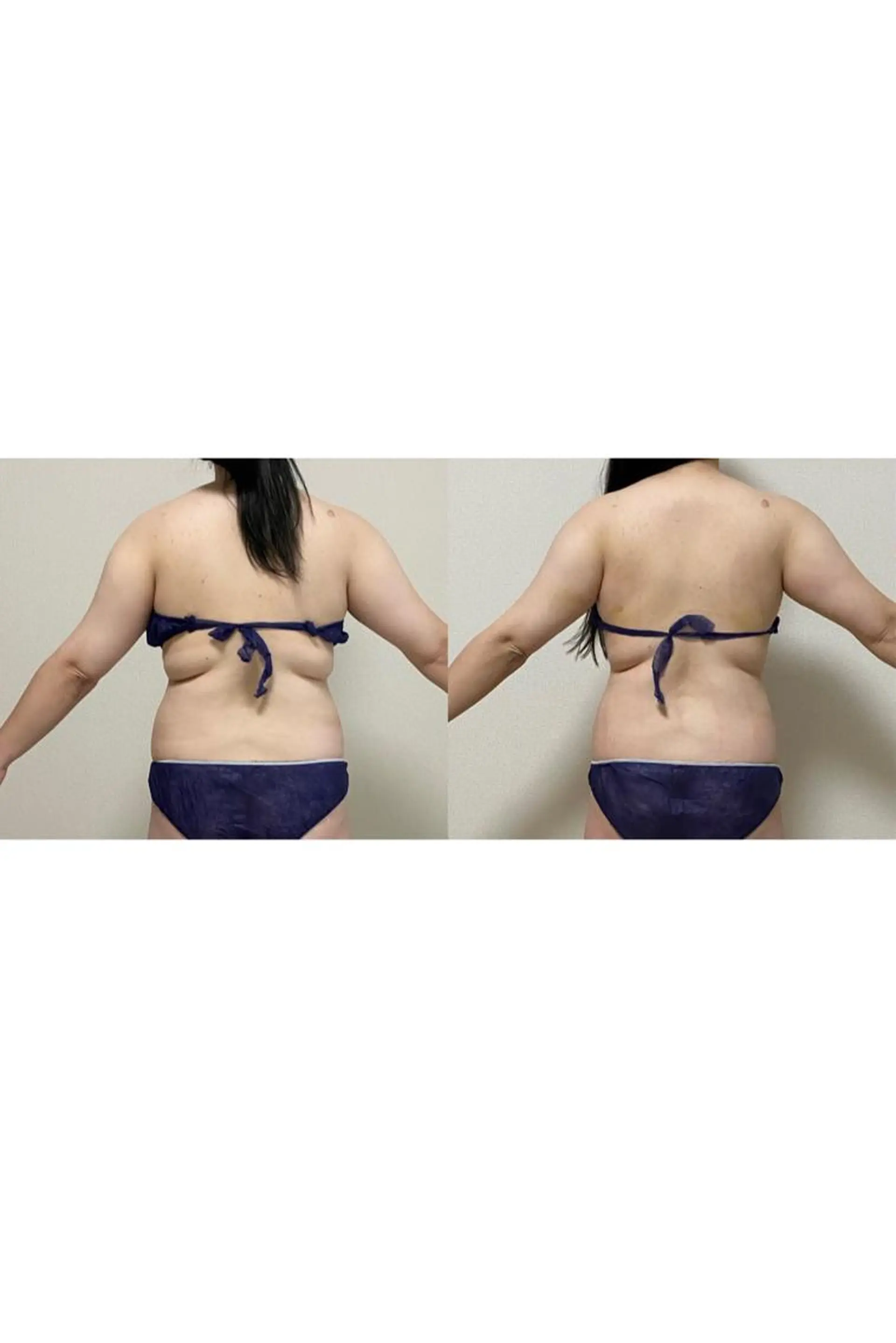 エステ 美容鍼灸サロンRemeリミー所属・美容鍼WINBACK サロンRemeのエステ・リラクイメージ