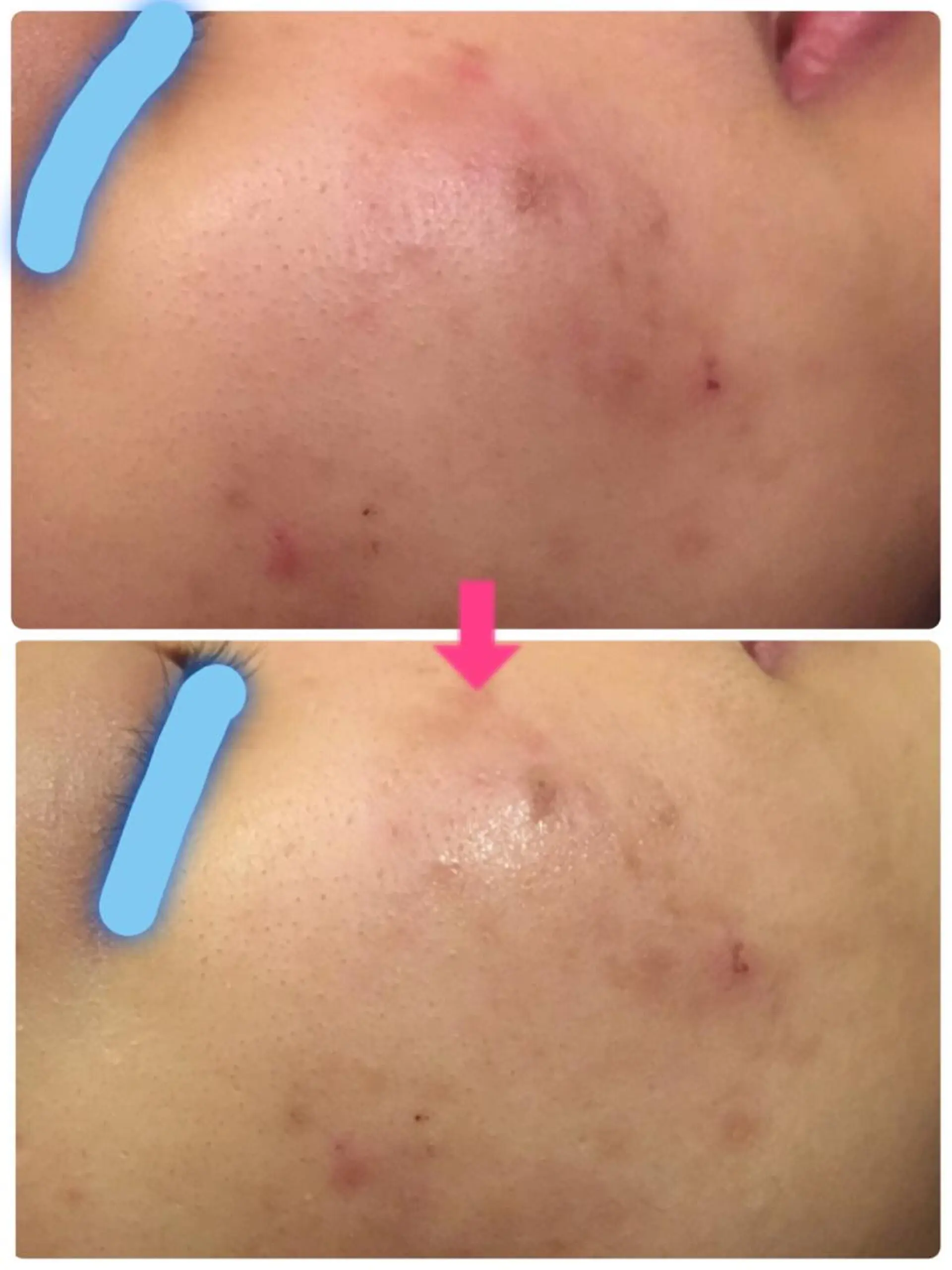 ショート カラー パーマ ヘアアレンジ メンズ キッズ ネイル マツエク・マツパ ‍痩身＆ボディ 結果出し🌟丹野のエステ・リラクイメージ