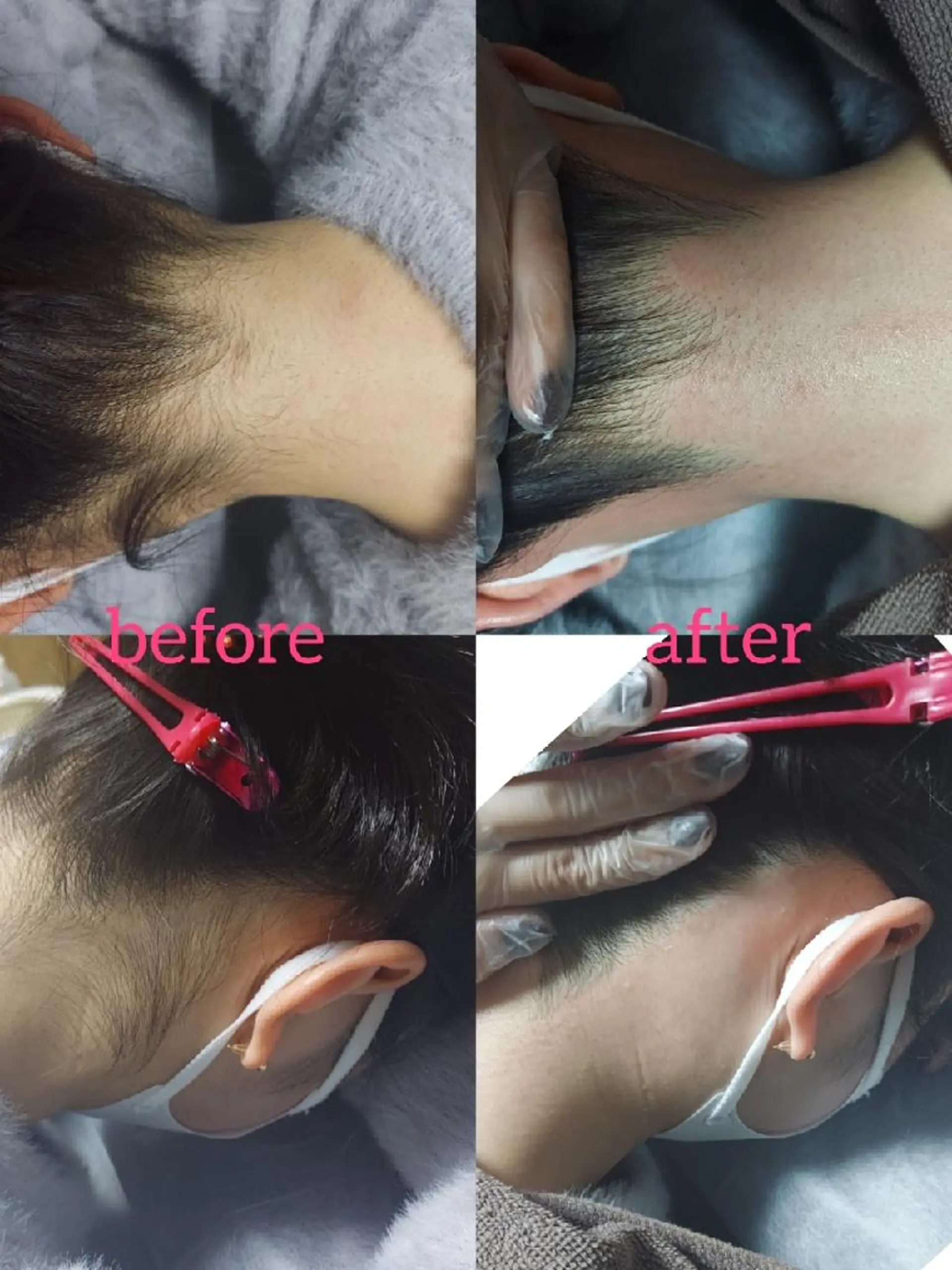 脱毛サロンLULA 恵比寿店濱野のエステ・リラクイメージ