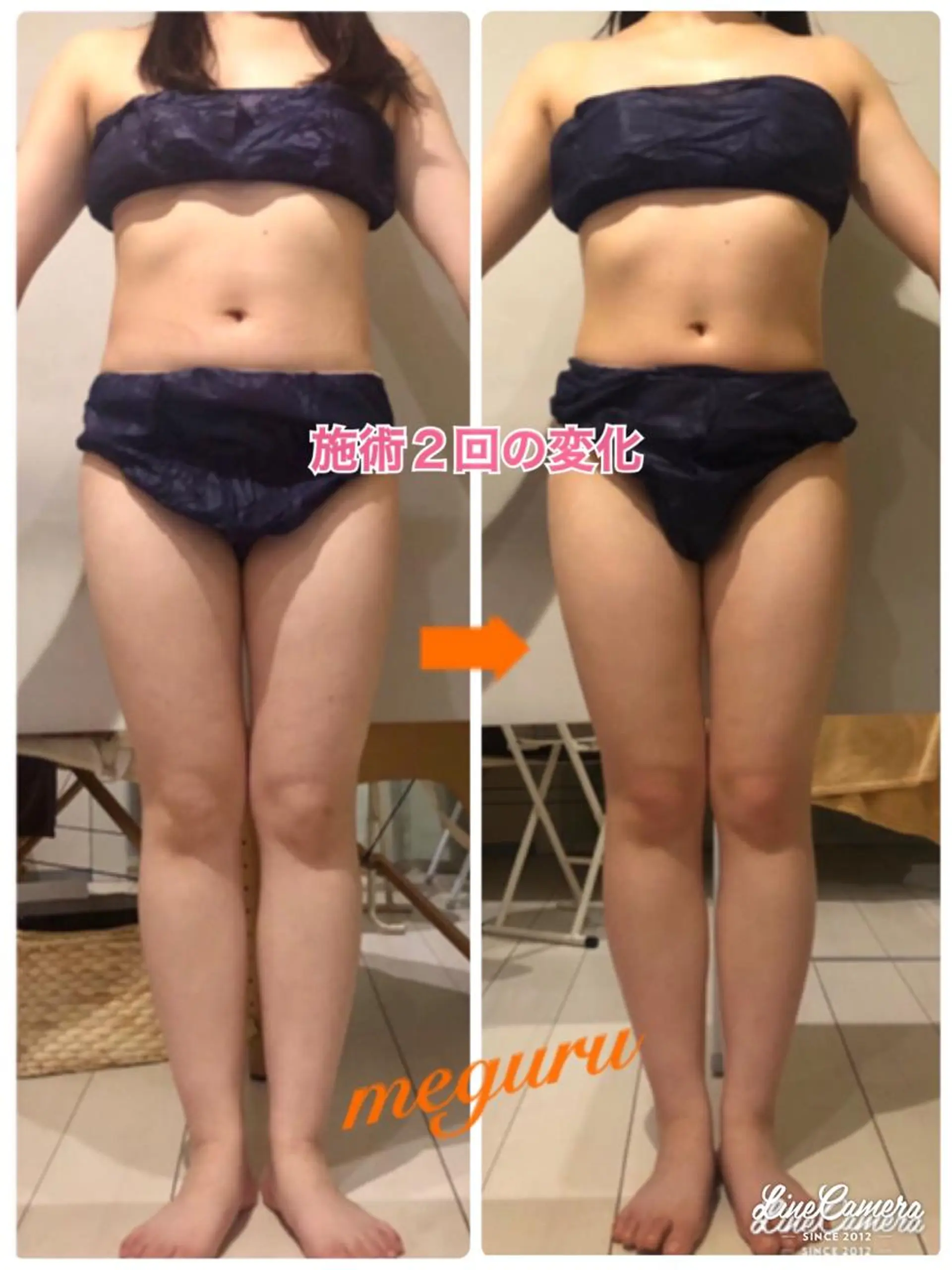 ショート カラー パーマ ヘアアレンジ メンズ キッズ ネイル マツエク・マツパ バレンタイン ‍痩身＆ボディ 結果出し🌟丹野のエステ・リラクイメージ