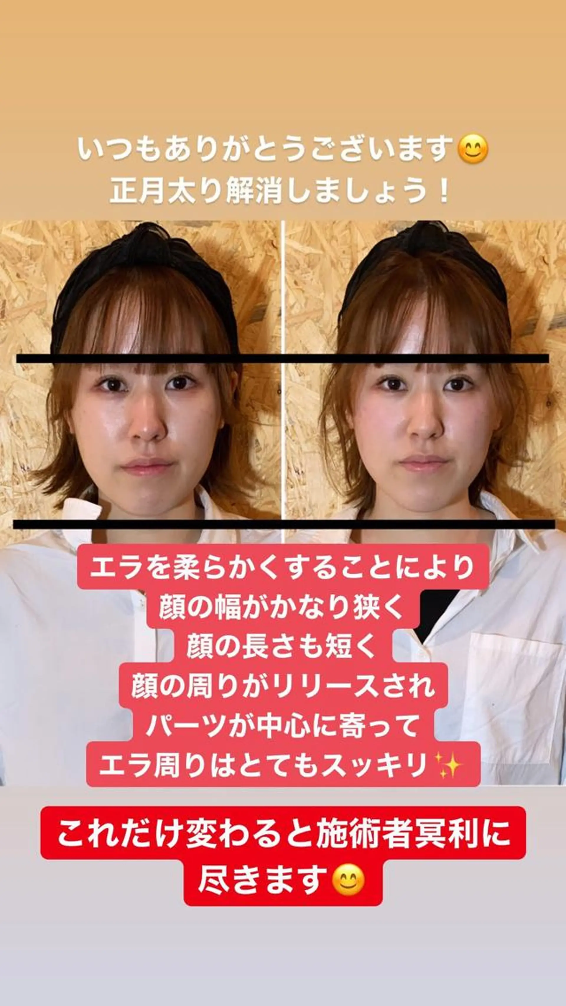 小顔×小顔×小顔 おくむらサロン所属・耳ツボジュエリー 3000円のエステ・リラクイメージ