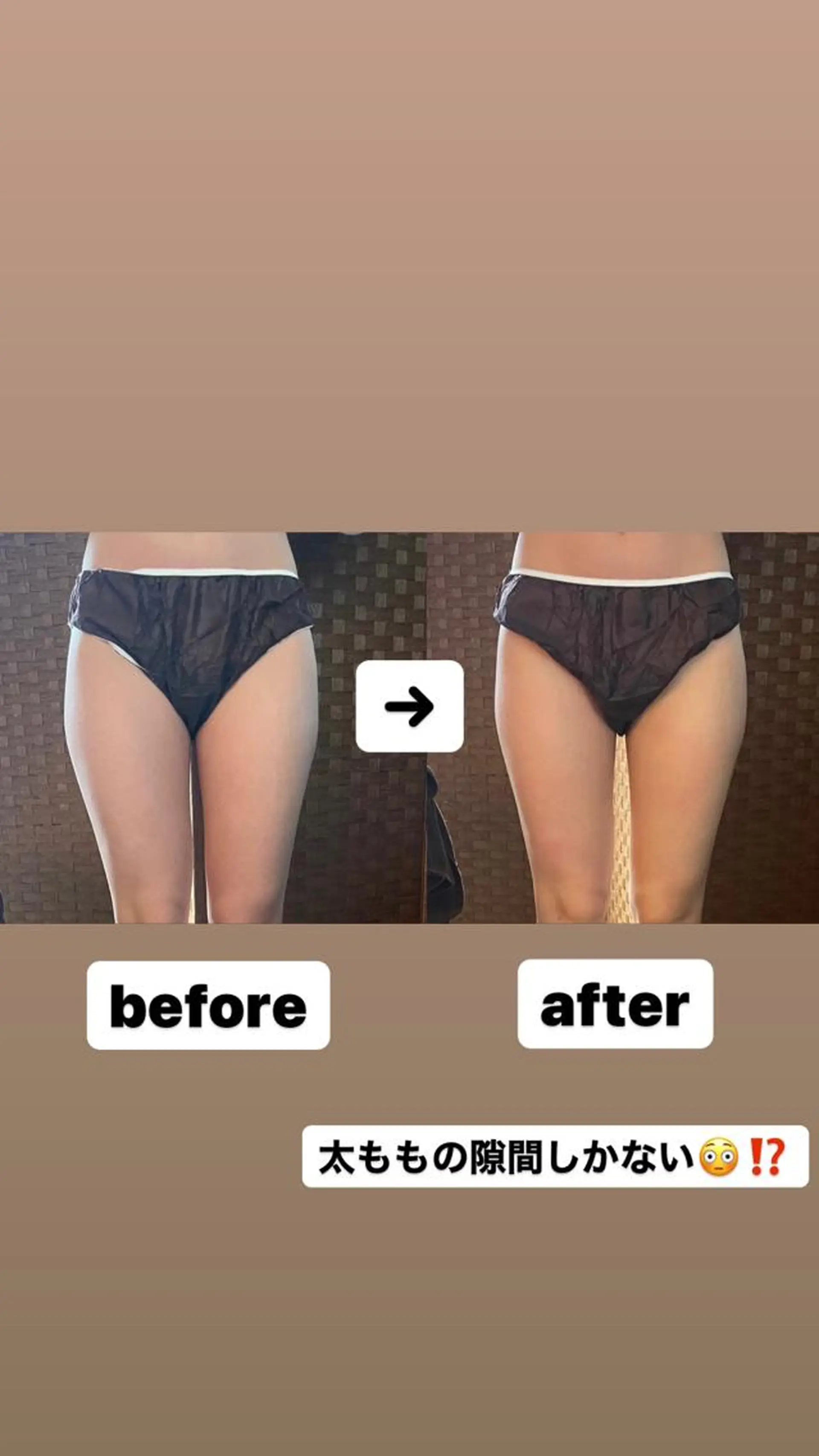 ネイル マツエク・マツパ アイブロウ 代表  山下 智景のエステ・リラクイメージ