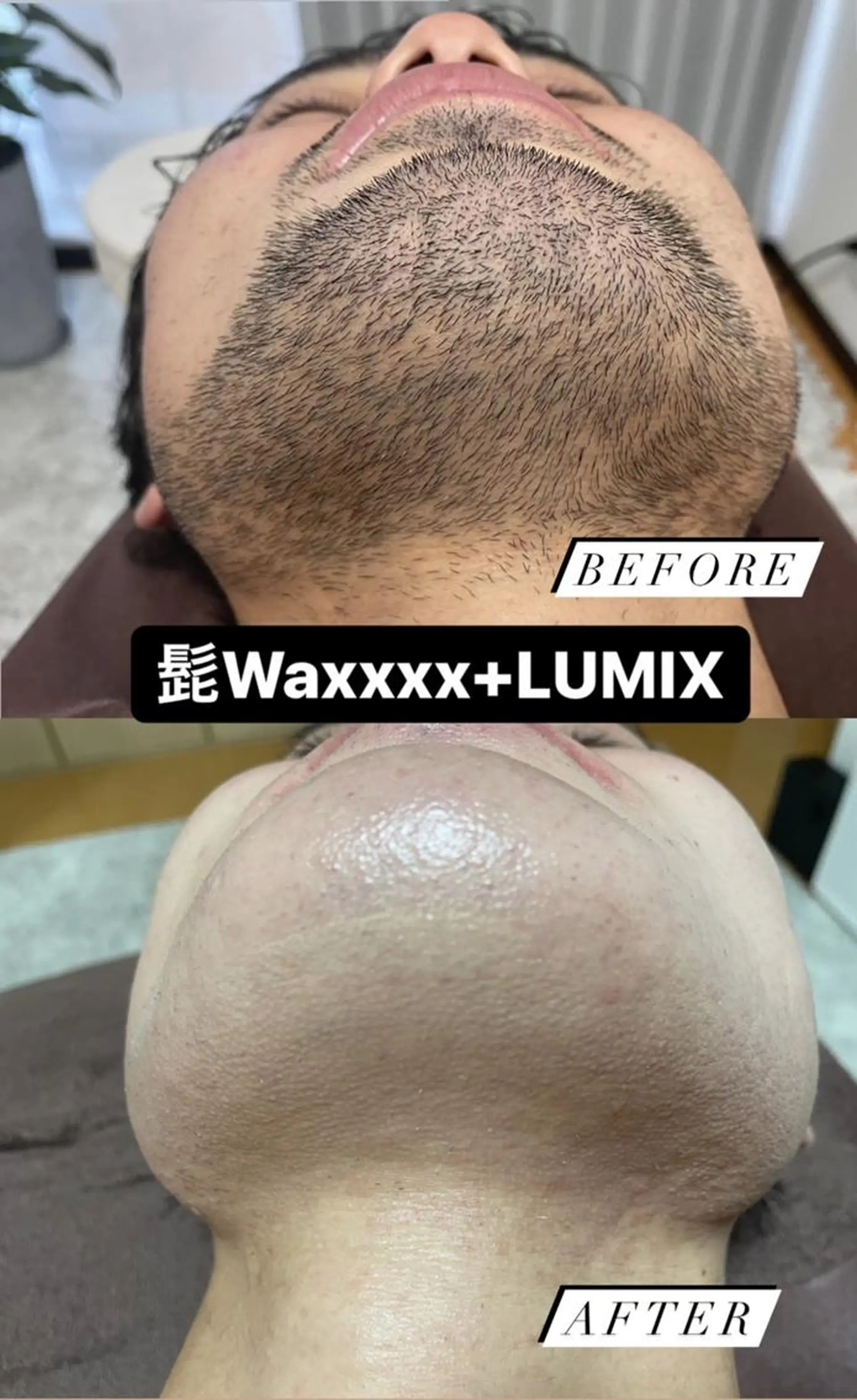 メンズ キッズ 脱毛 Epina 千葉店 【エピナ】のエステ・リラクイメージ