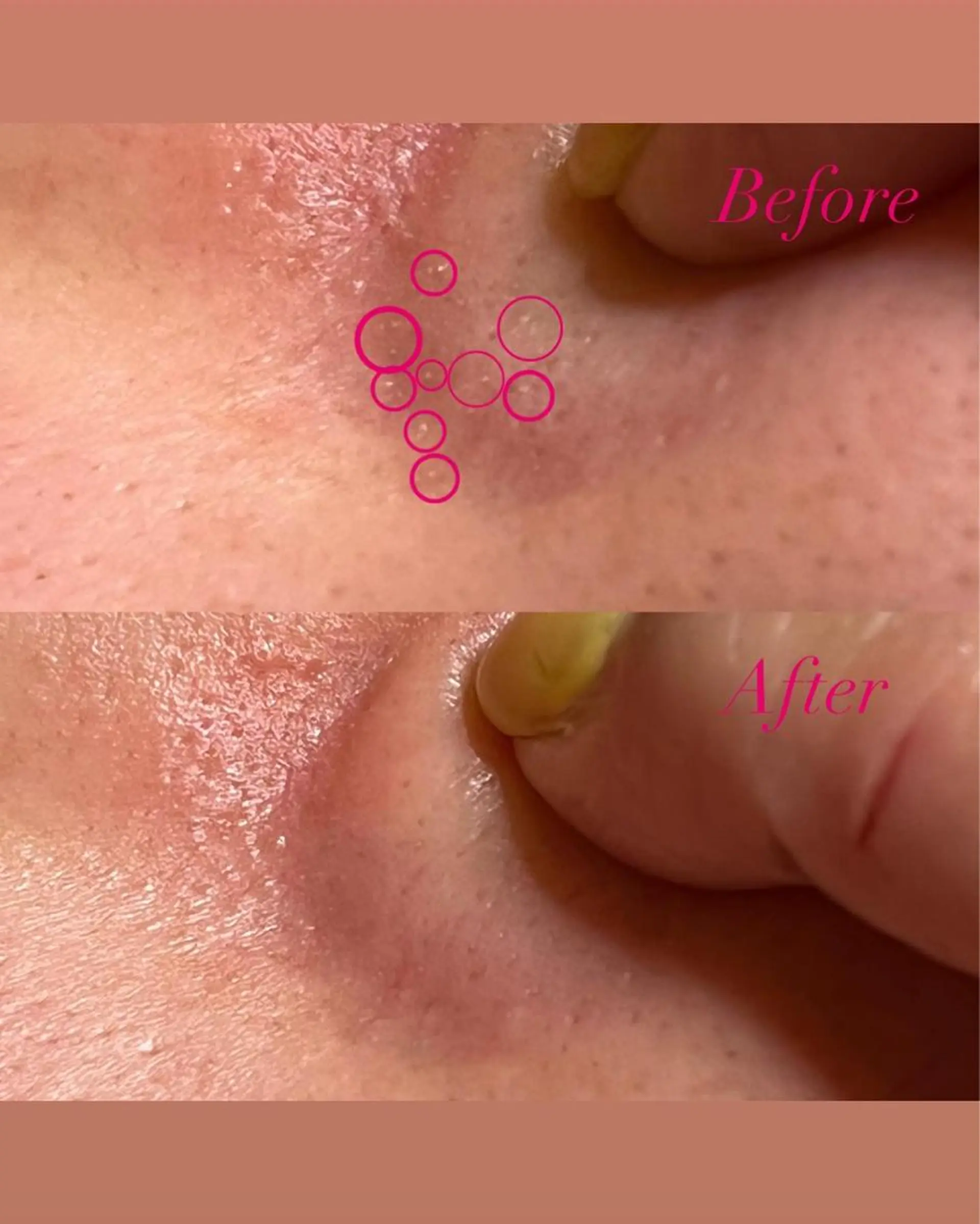 Belle fee 山口のマツエク・マツパデザイン