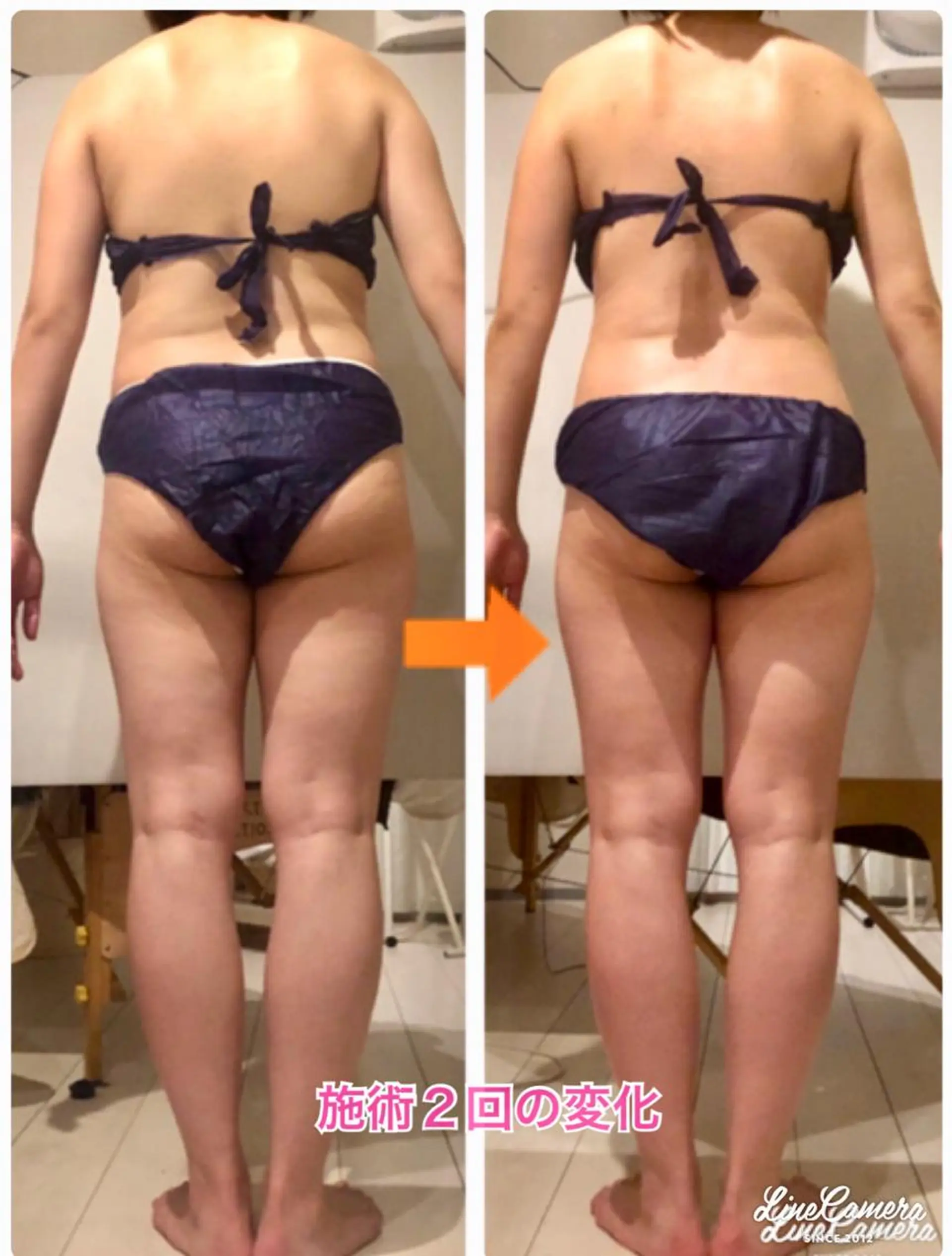 ショート カラー パーマ ヘアアレンジ メンズ キッズ ネイル マツエク・マツパ ‍痩身＆ボディ 結果出し🌟丹野のエステ・リラクイメージ