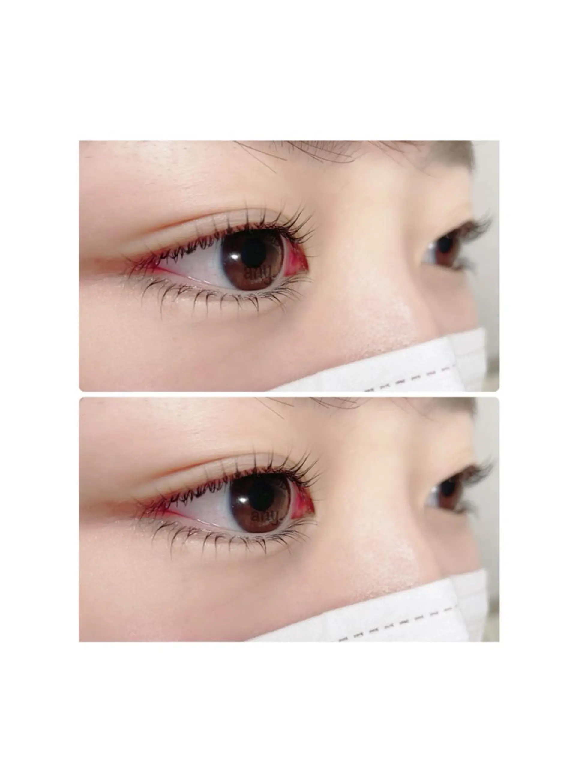 マツエク・マツパ any🏝 エニーのマツエク・マツパデザイン