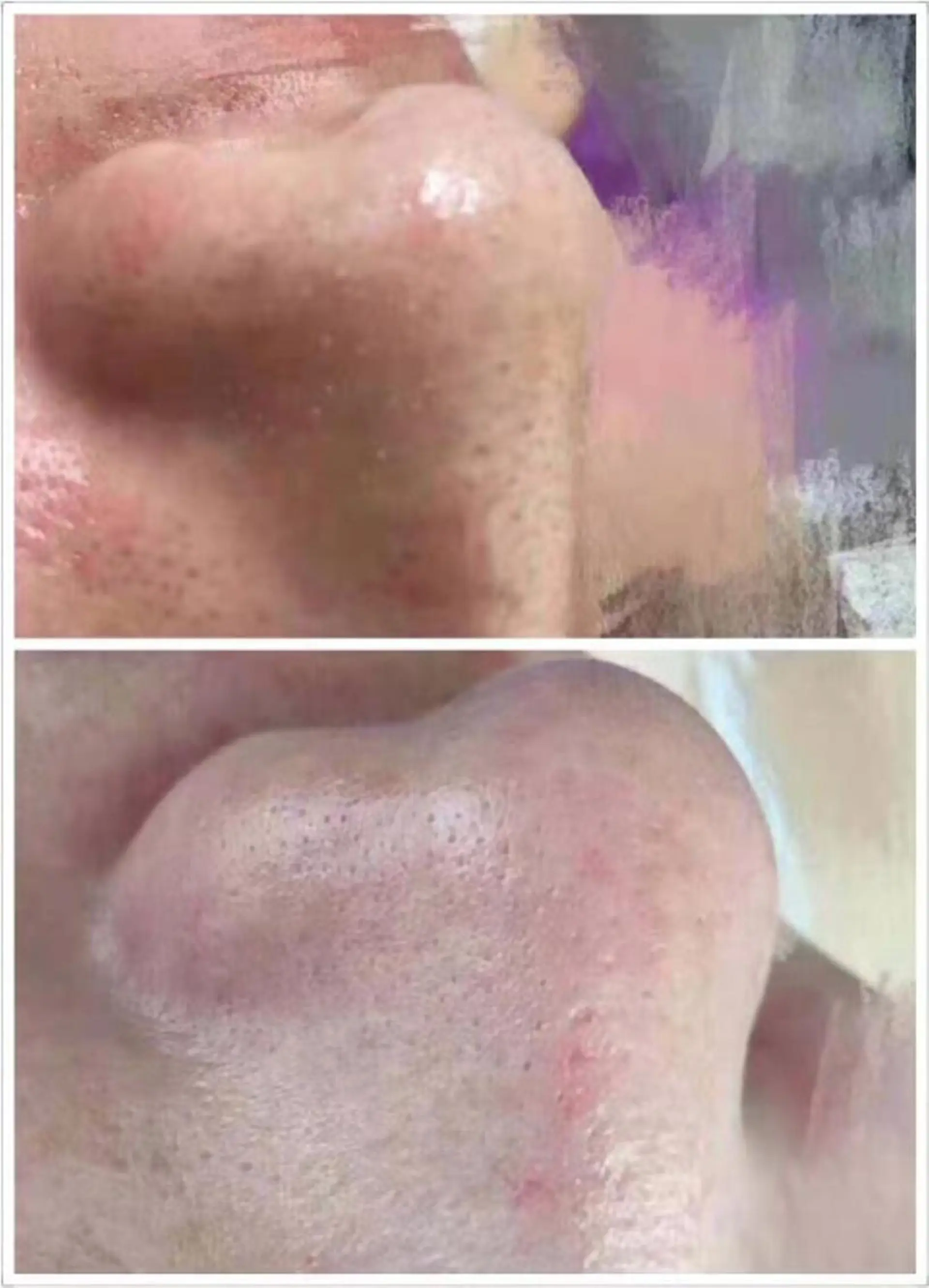 ホワイトビューティ サロンのエステ・リラクイメージ