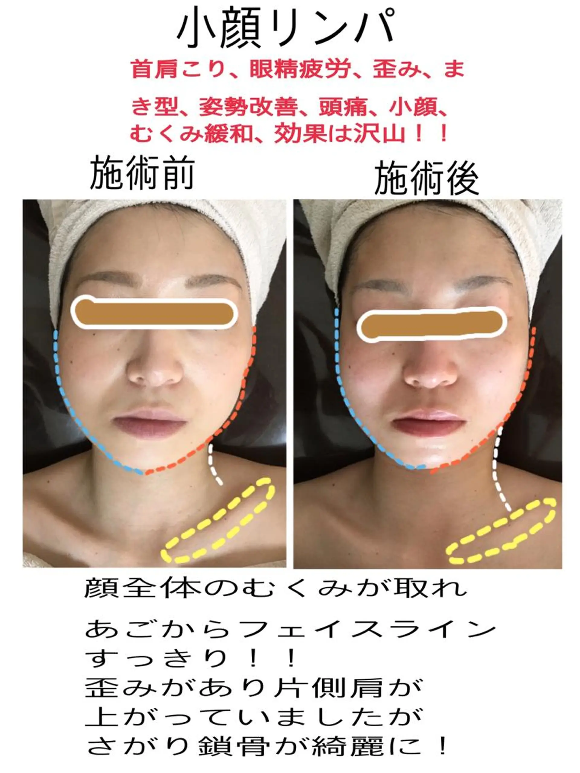 美筋骨格リンパ®️ Aroleのエステ・リラクイメージ