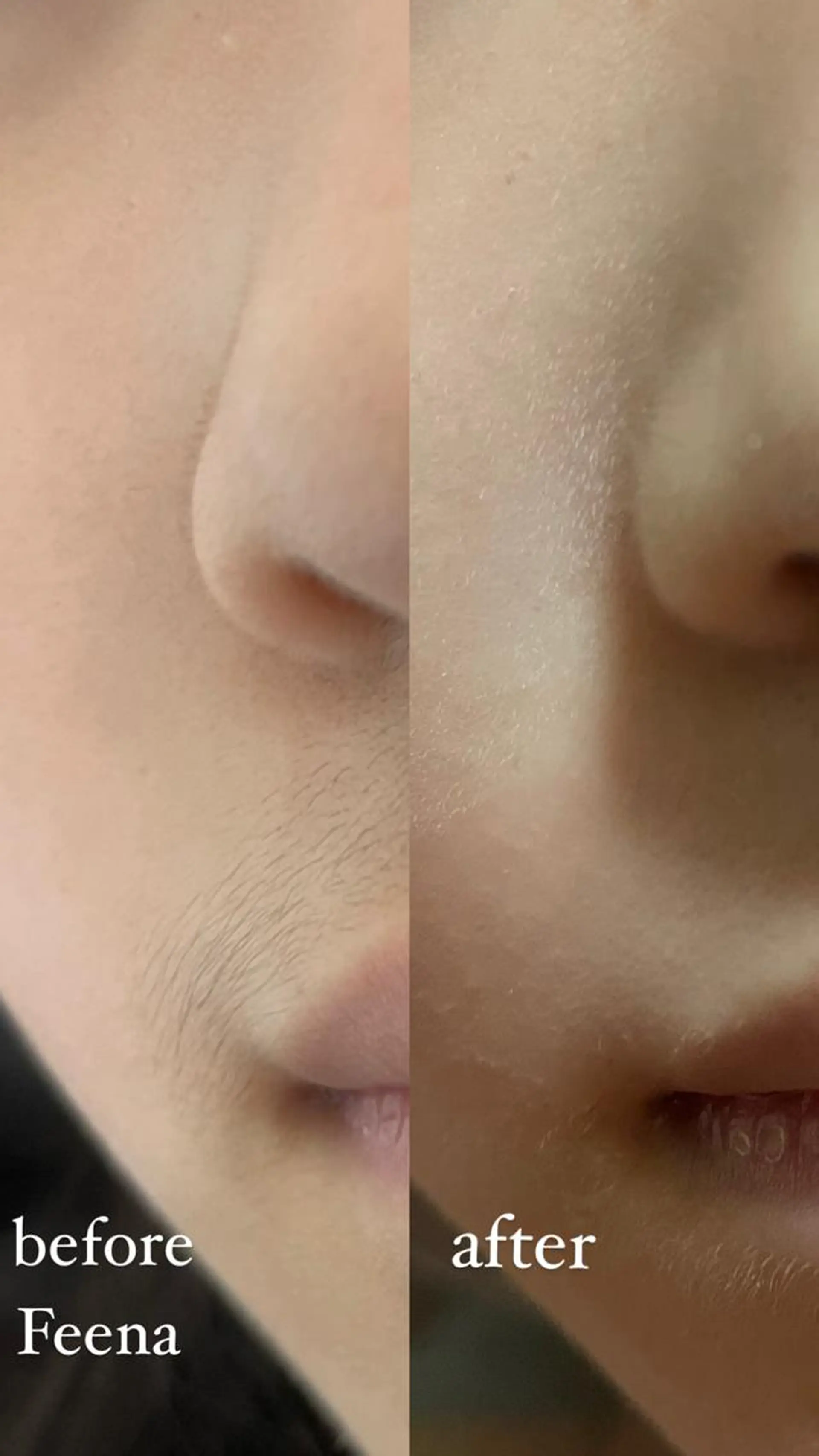 amu nail. RINAのネイルデザイン