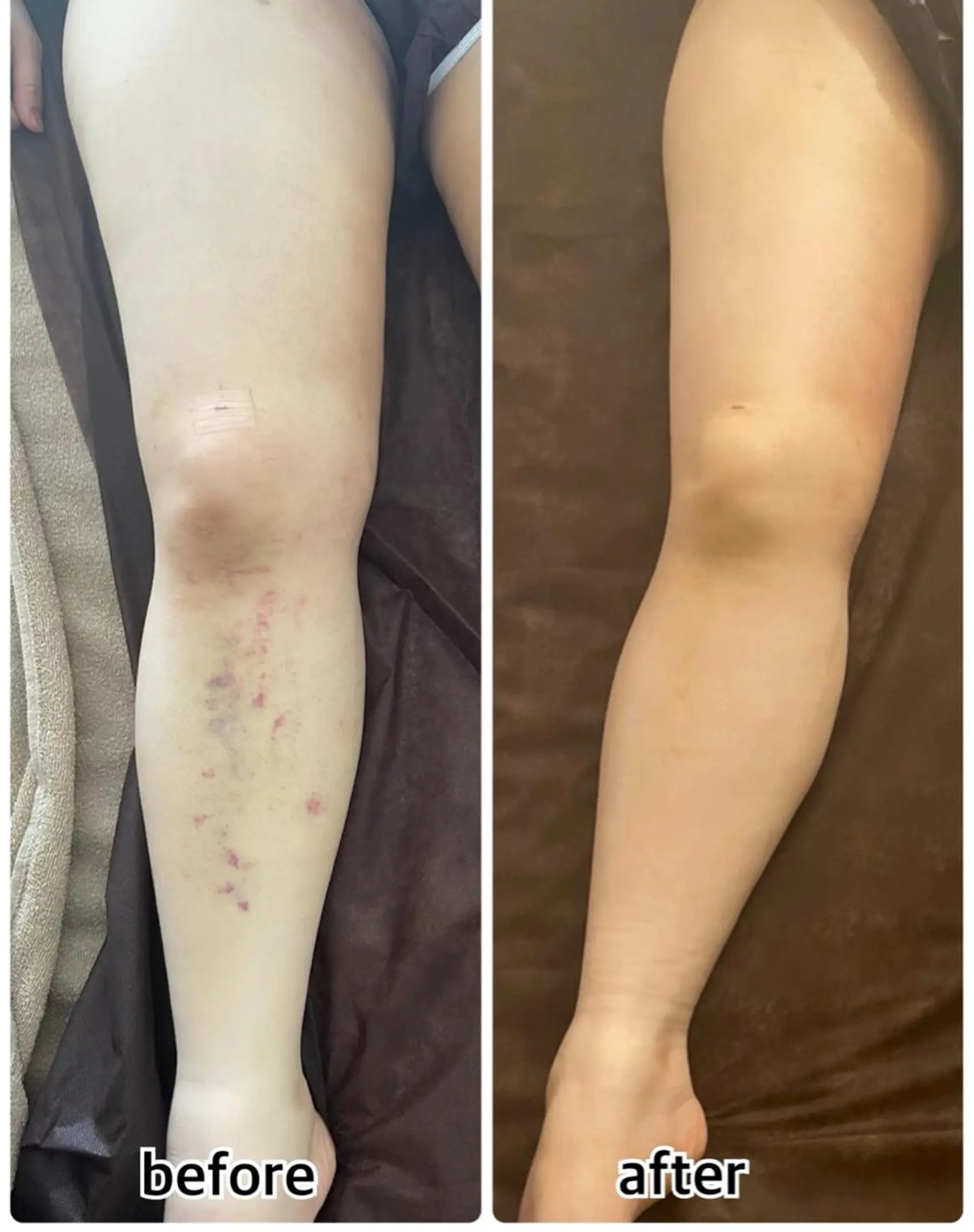 💎インディバ GEM💎indiba   healing room GEM所属・💎 GEM💎のエステ・リラクイメージ