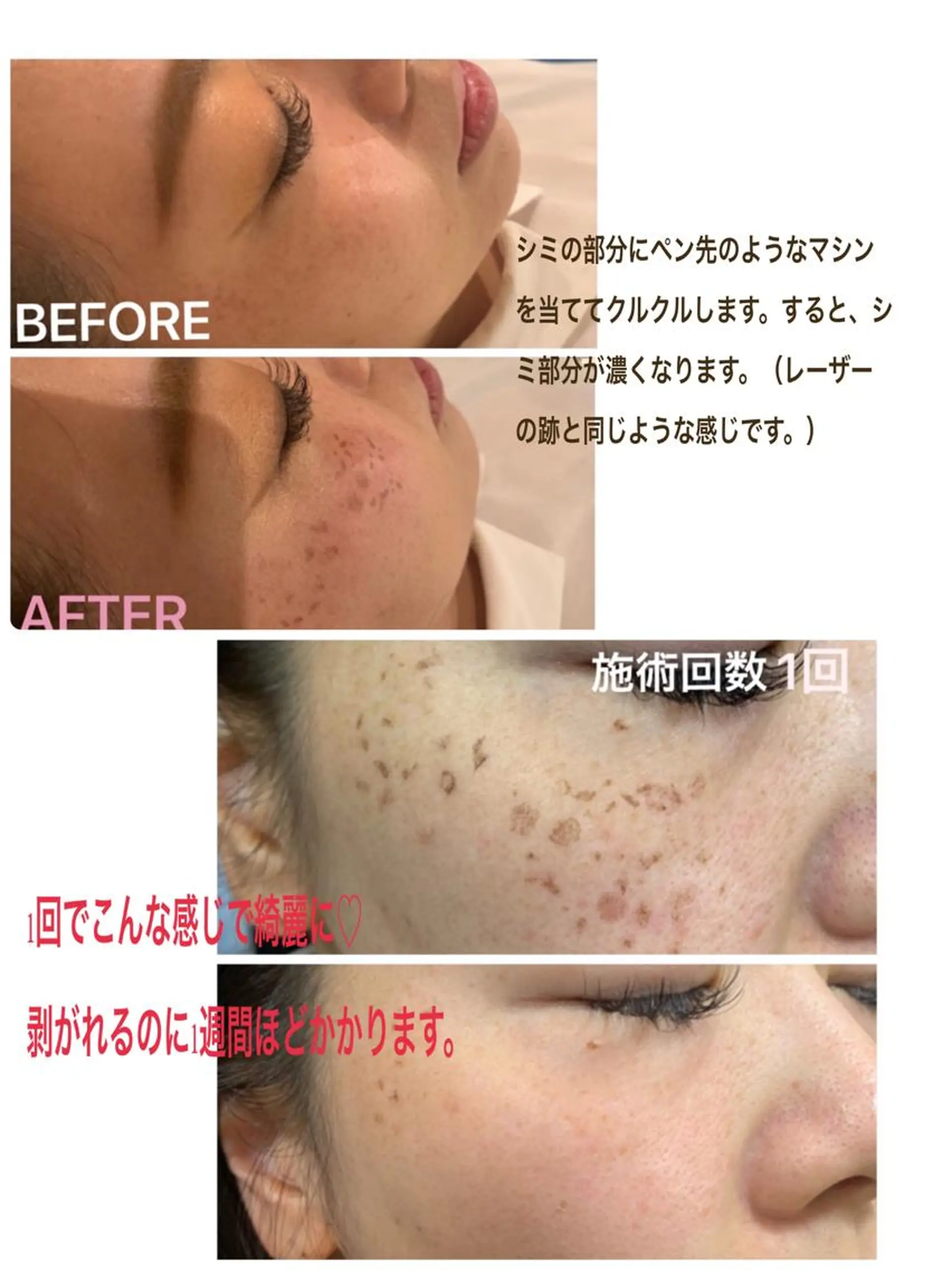 首・肩こり専門リンパ ケアサロンSENKAのエステ・リラクイメージ