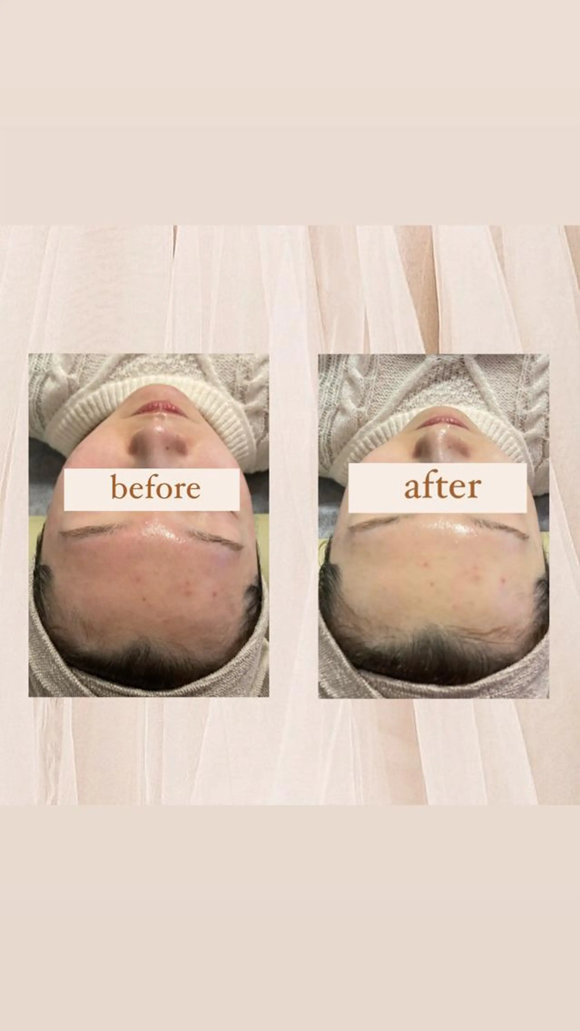 エステ crescent所属・【韓国肌管理・脱毛】 クレセントのその他イメージ