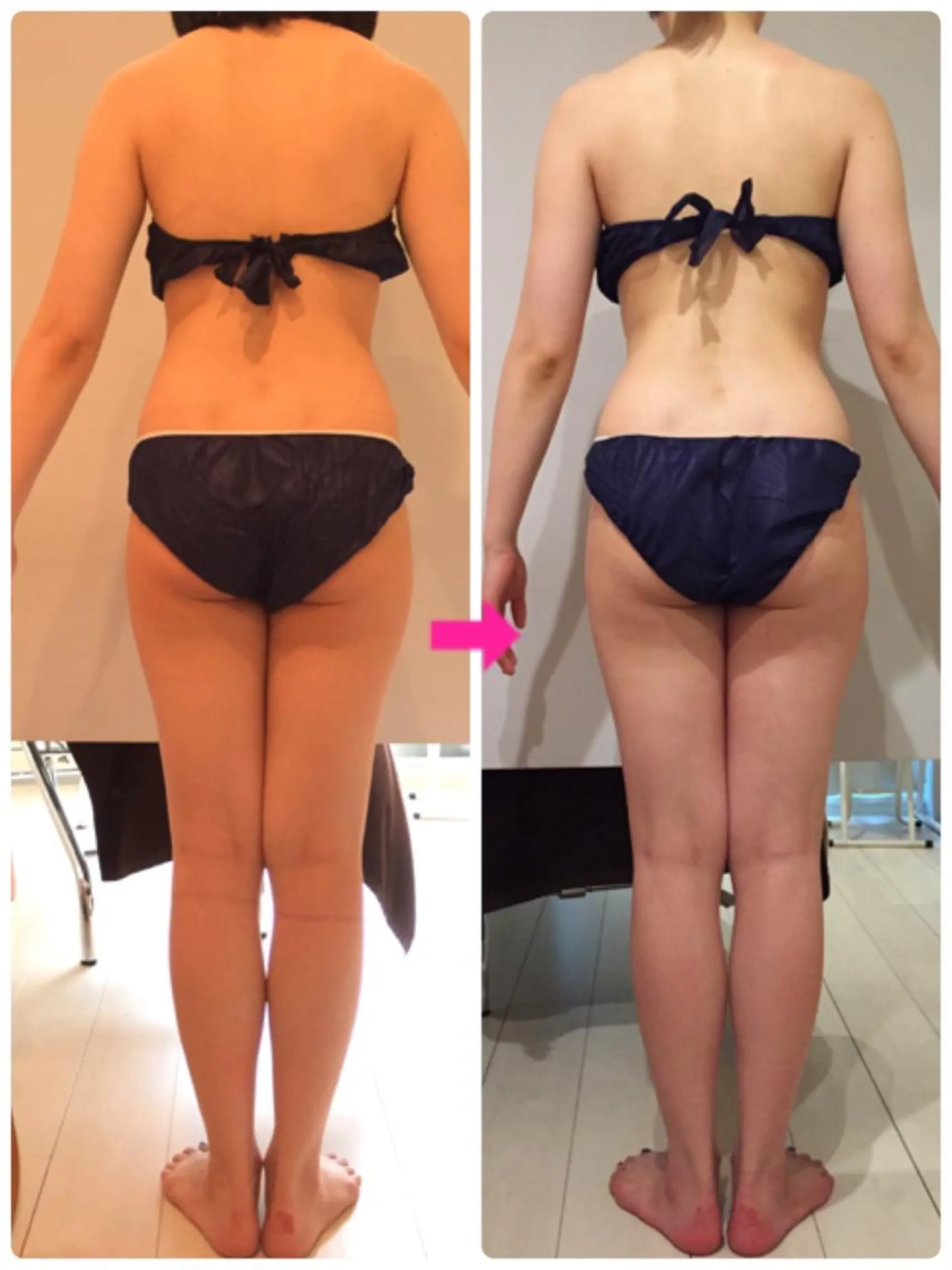 ロング カラー パーマ ヘアアレンジ メンズ キッズ ネイル マツエク・マツパ ‍痩身＆ボディ 結果出し🌟丹野のエステ・リラクイメージ