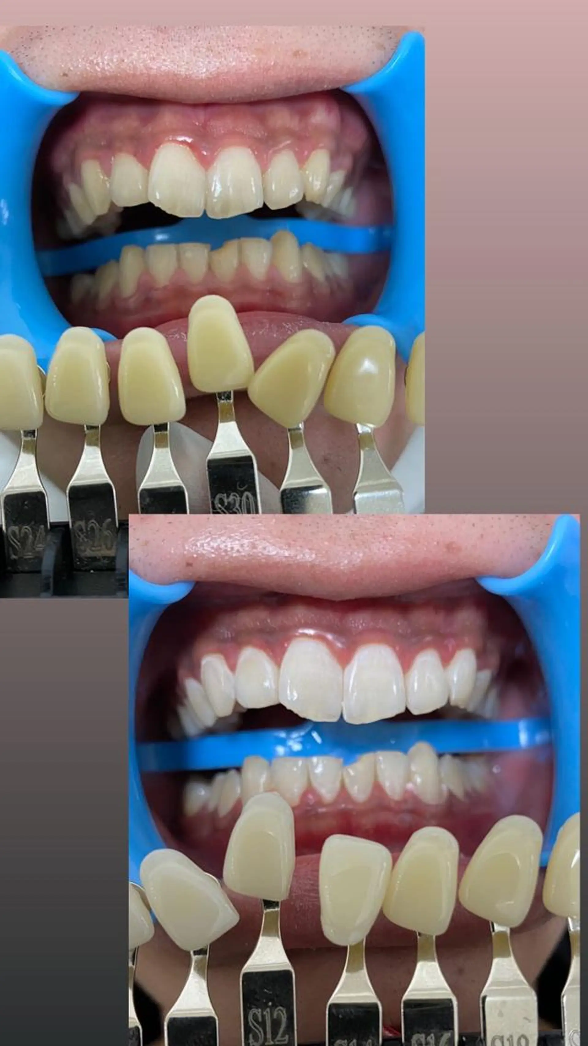 DIA WHITE 奥田のその他イメージ