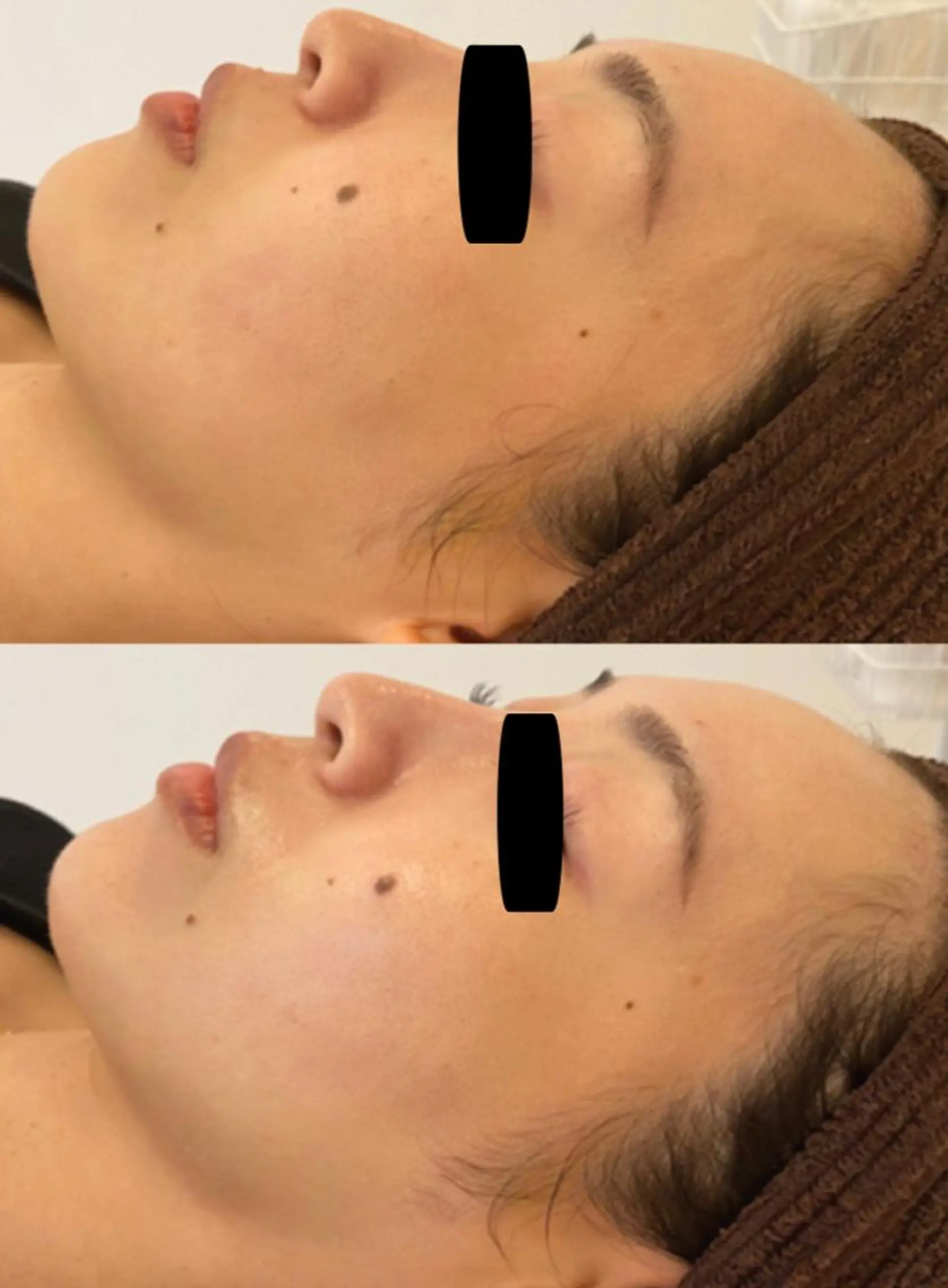 脱毛｜ピーリング ROOM.Sのエステ・リラクイメージ