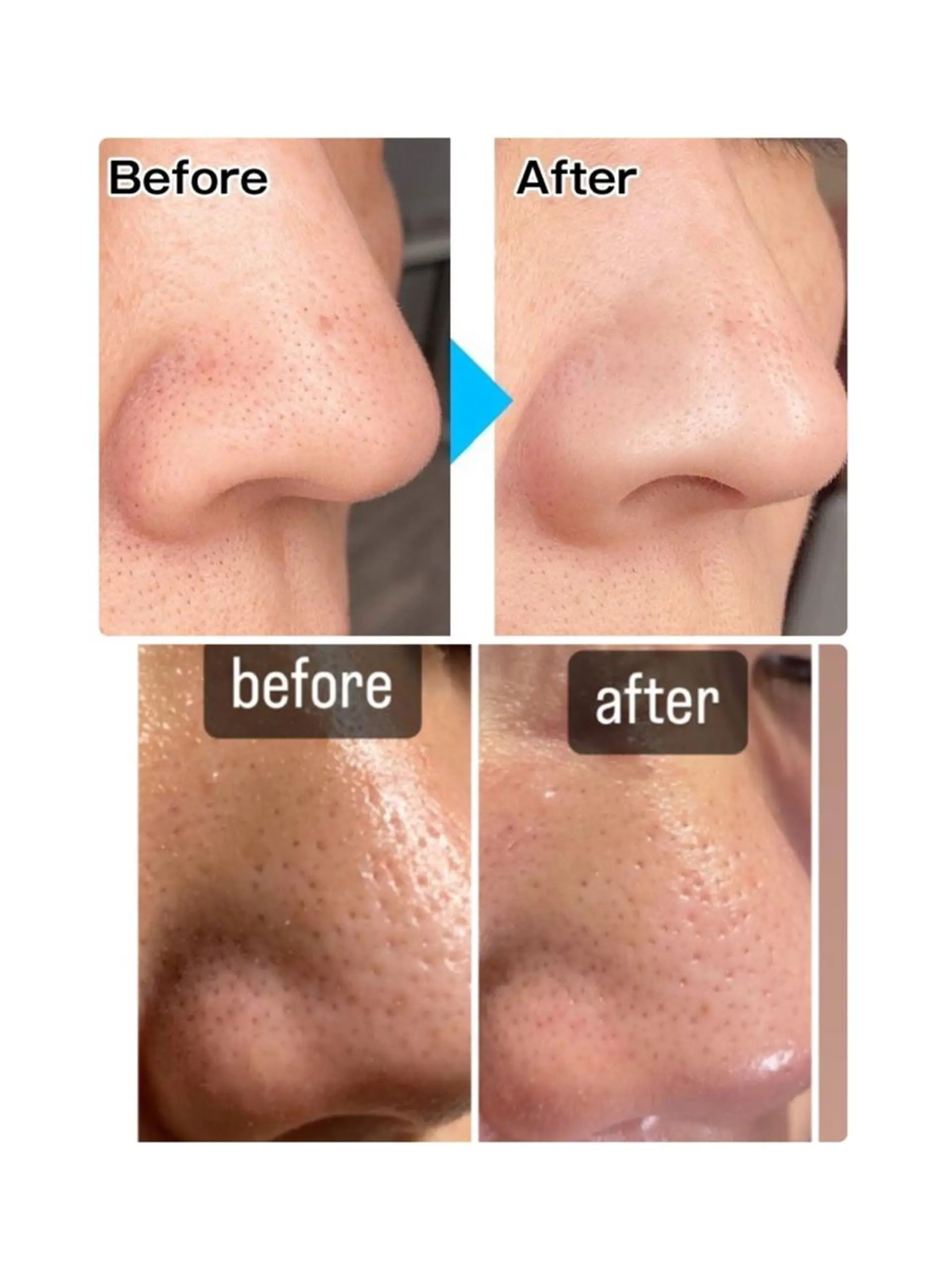 脱毛・エステサロン LuLuNのエステ・リラクイメージ