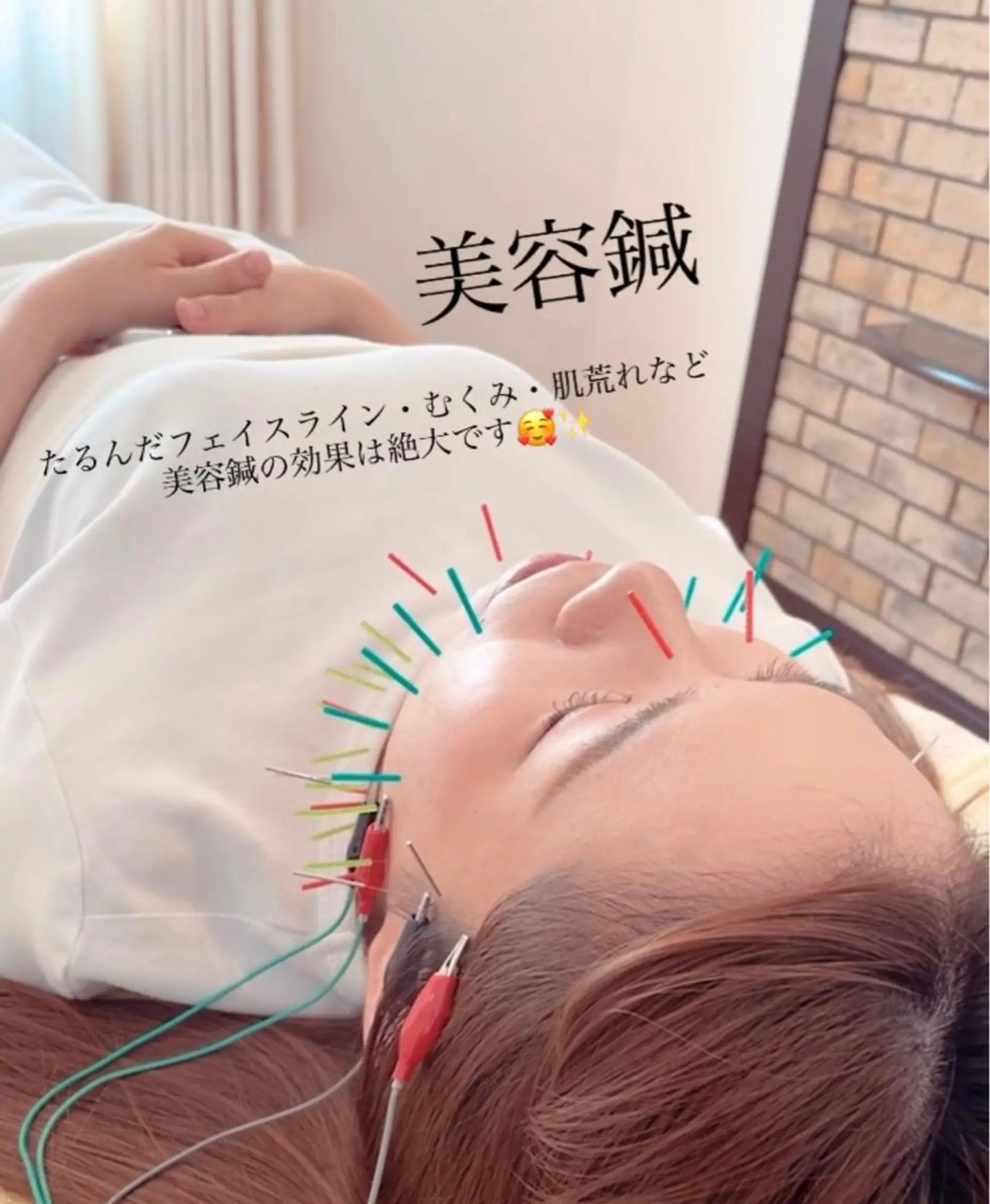 美容鍼灸サロン　TIARA所属・鍼灸サロン TIARA　美容鍼のエステ・リラクイメージ