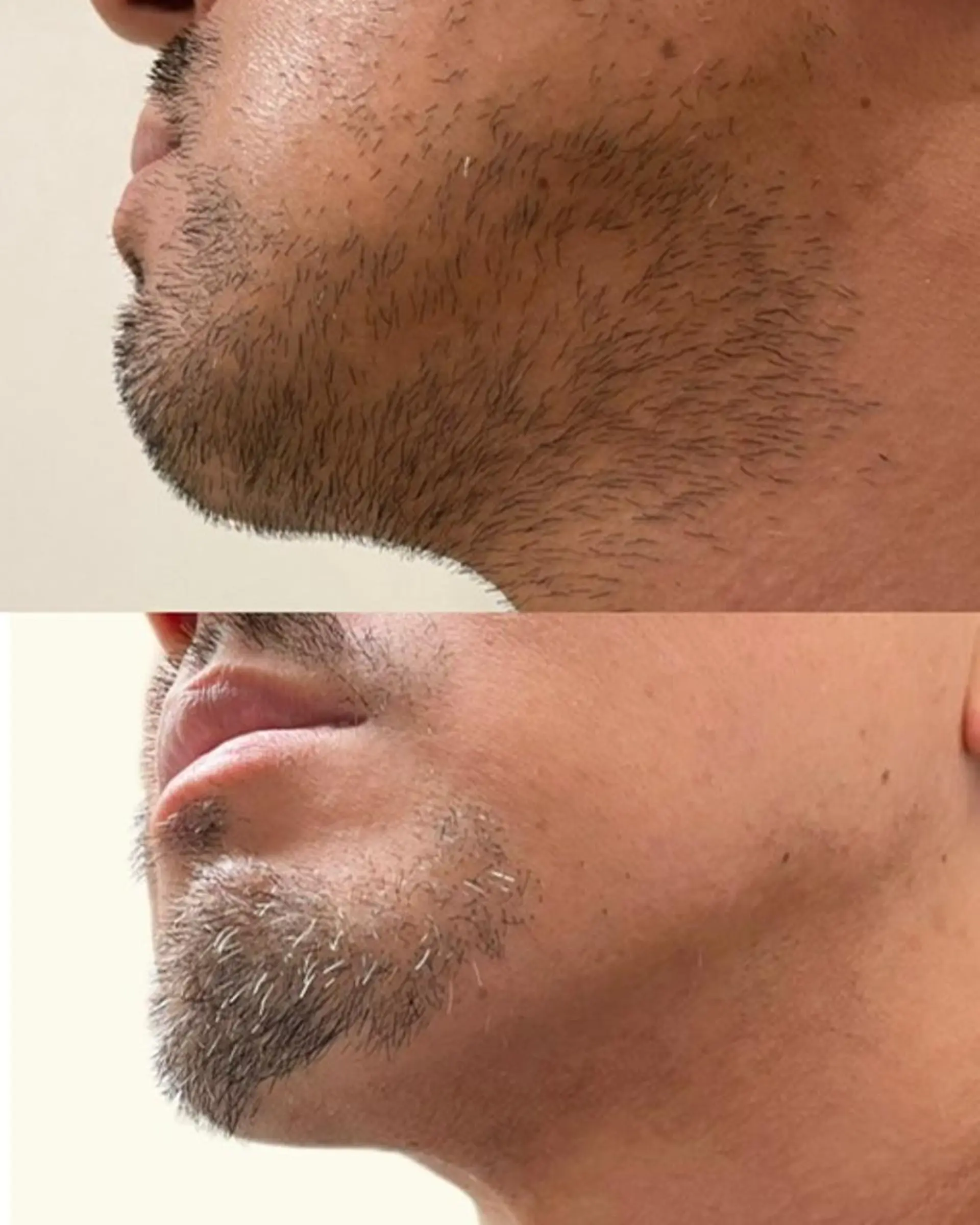 メンズ 脱毛 メンズビューティー 池村哲雄のエステ・リラクイメージ