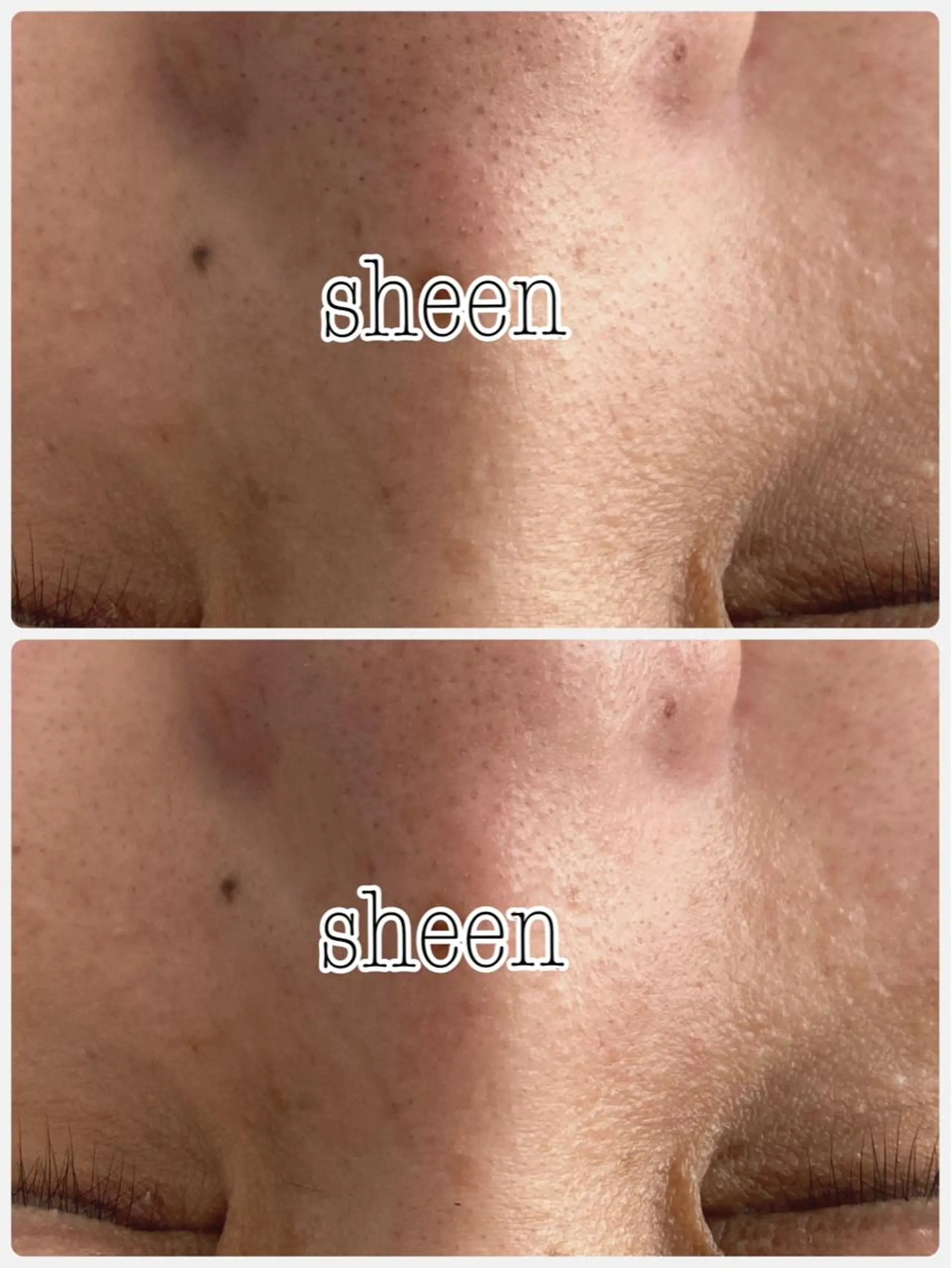 Chalon所属・REVI取扱・肌悩み 毛穴Chalonのエステ・リラクイメージ