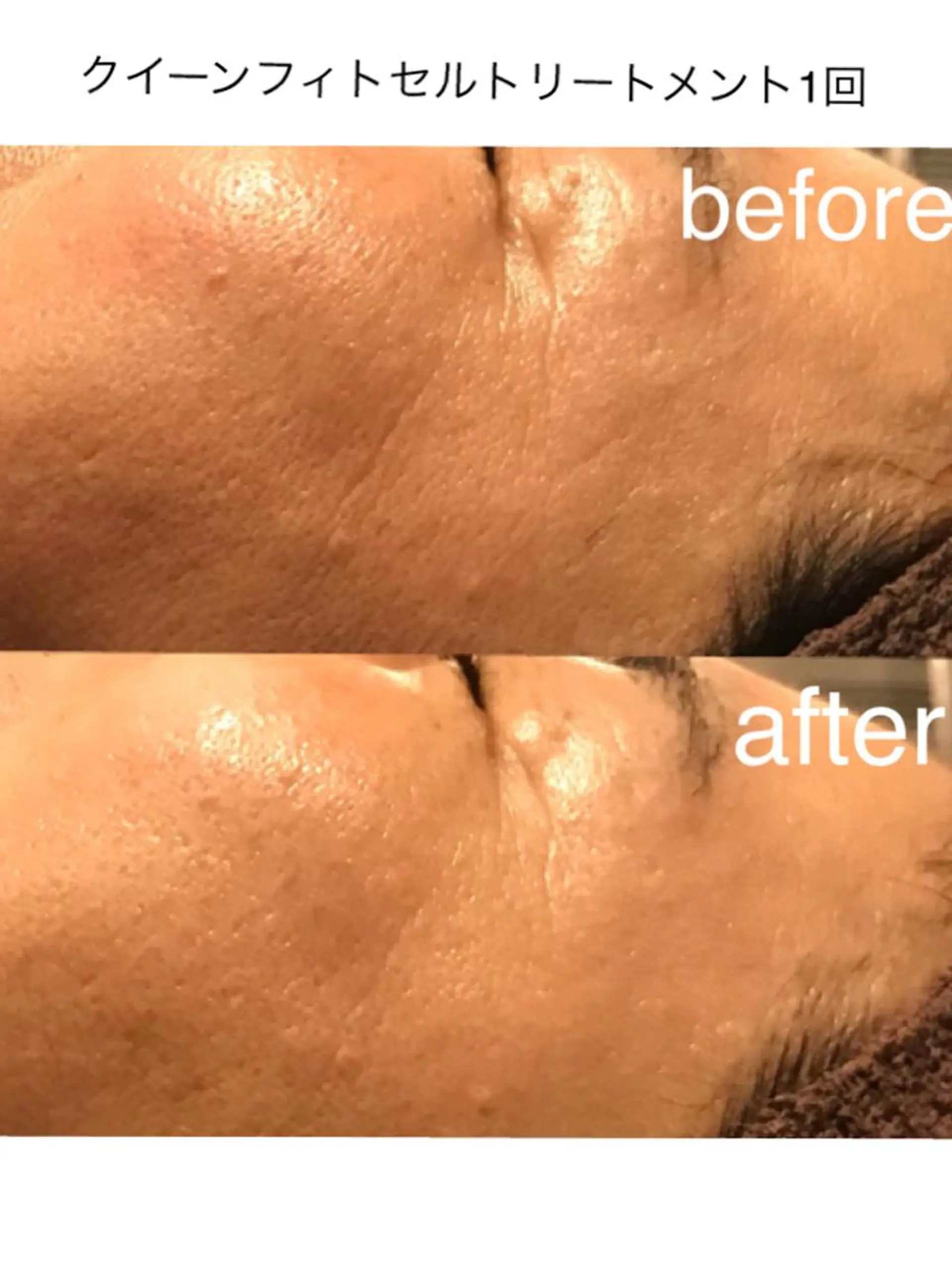 エステ 浜野 恵美のエステ・リラクイメージ