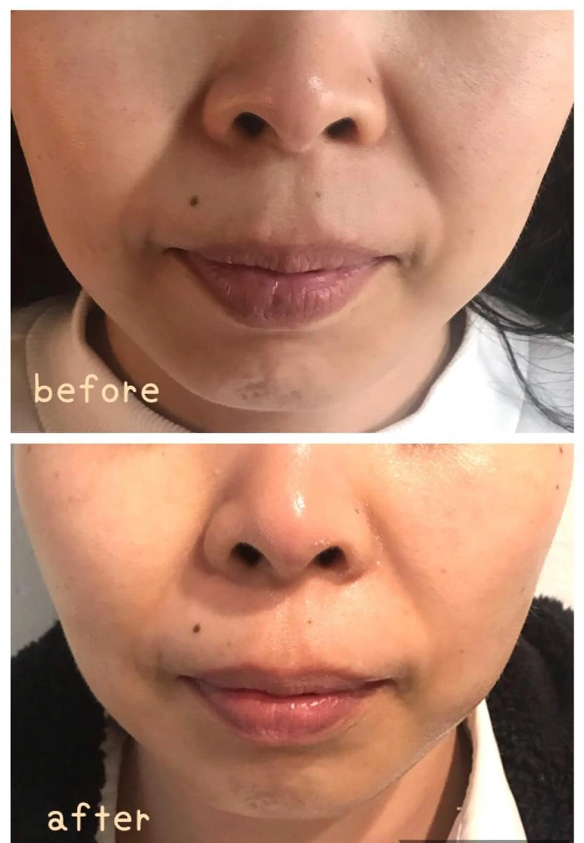 grow所属・Yoshino Erinaのエステ・リラクイメージ