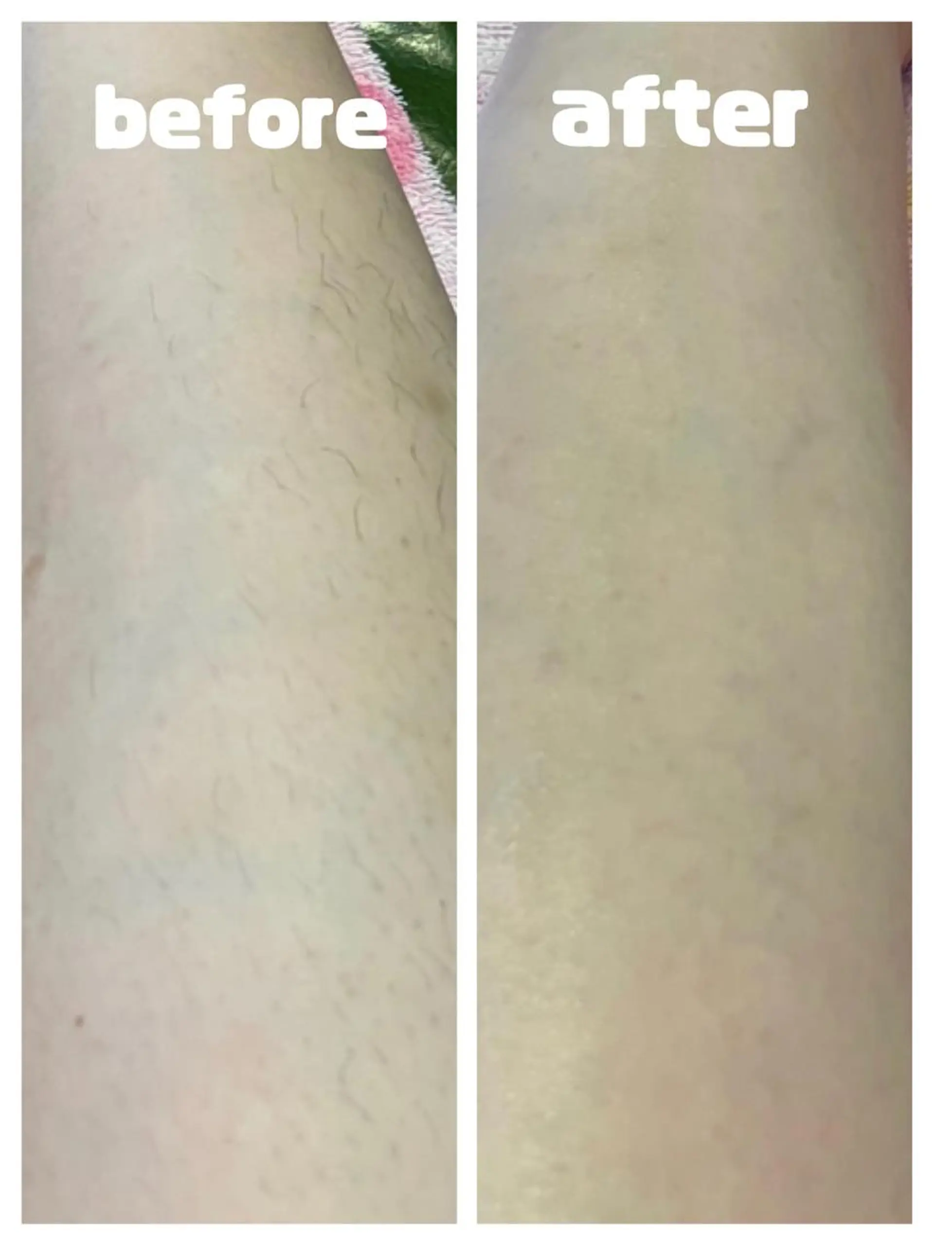 脱毛 benebene所属・古岡 愛のエステ・リラクイメージ