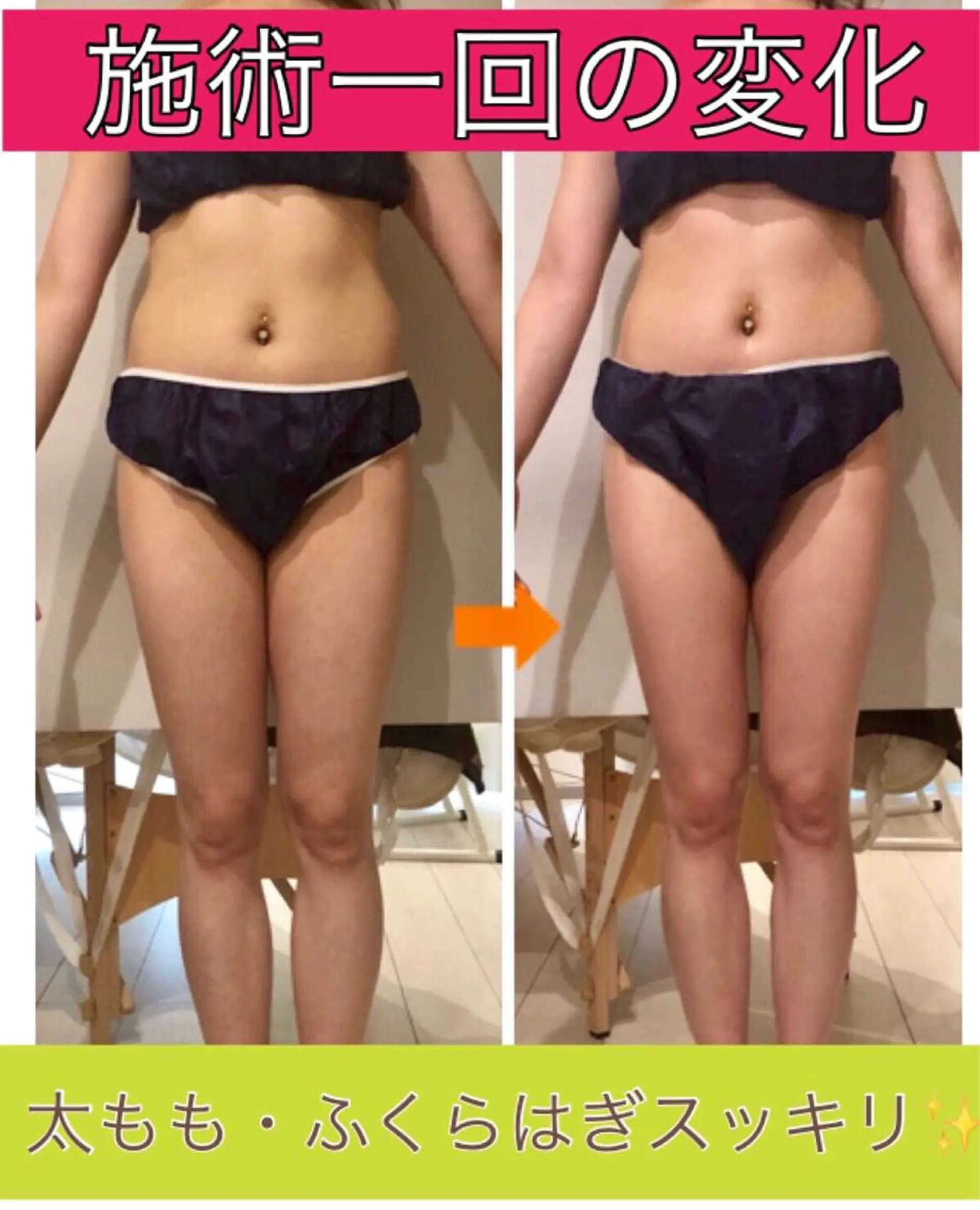 ロング カラー パーマ ヘアアレンジ メンズ キッズ ネイル マツエク・マツパ ‍痩身＆ボディ 結果出し🌟丹野のエステ・リラクイメージ