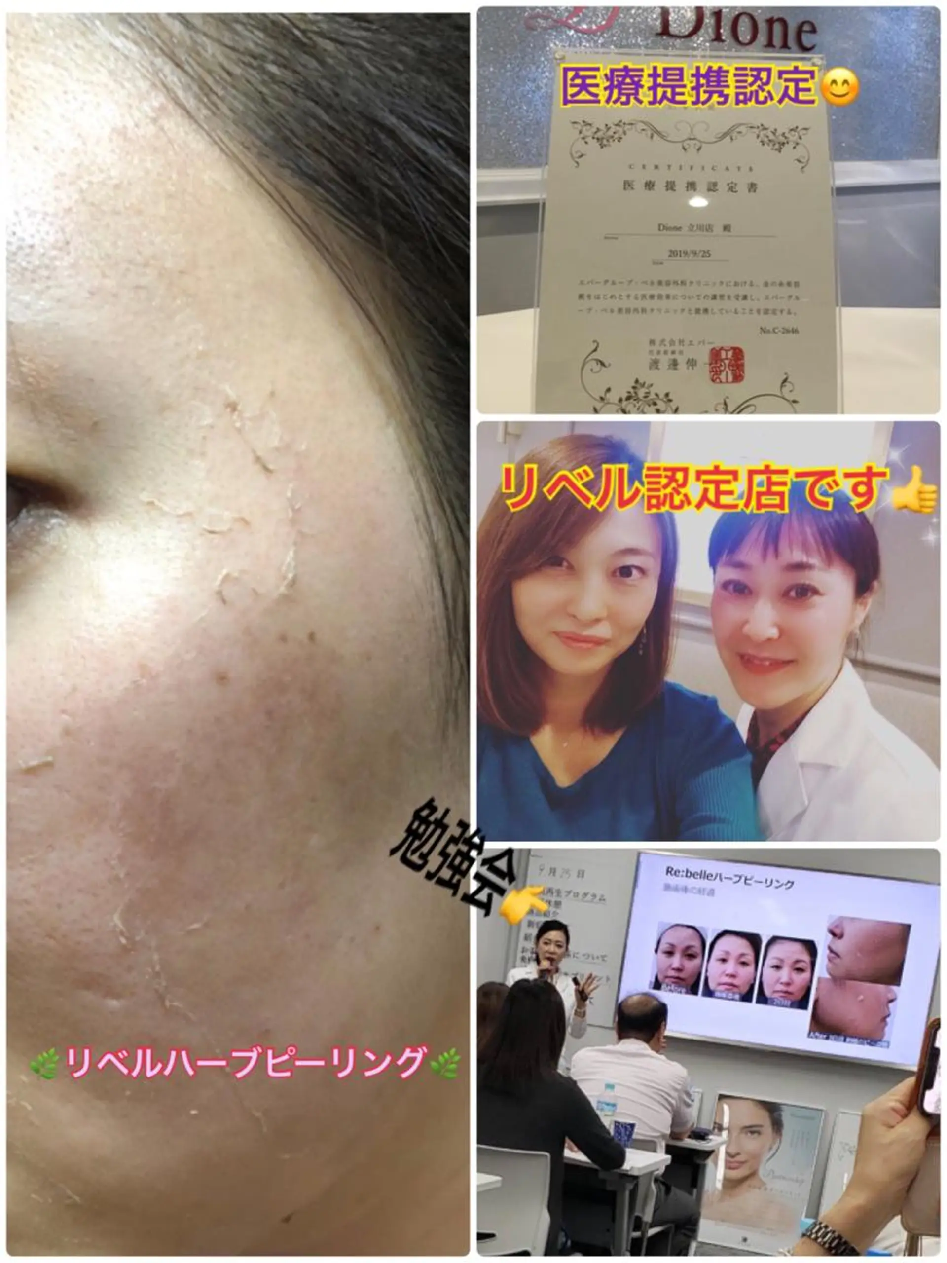 エステ 【リベルハーブピーリング認定店】敏感肌・美白脱毛専門店Dione立川店所属・Dione 立川店のエステ・リラクイメージ