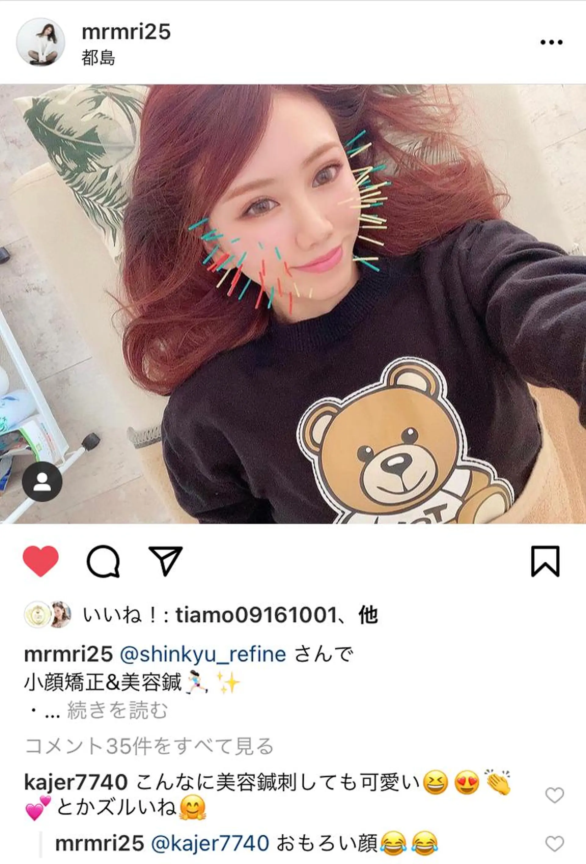 鍼灸整骨院Refine所属・鍼灸 Refineのその他イメージ