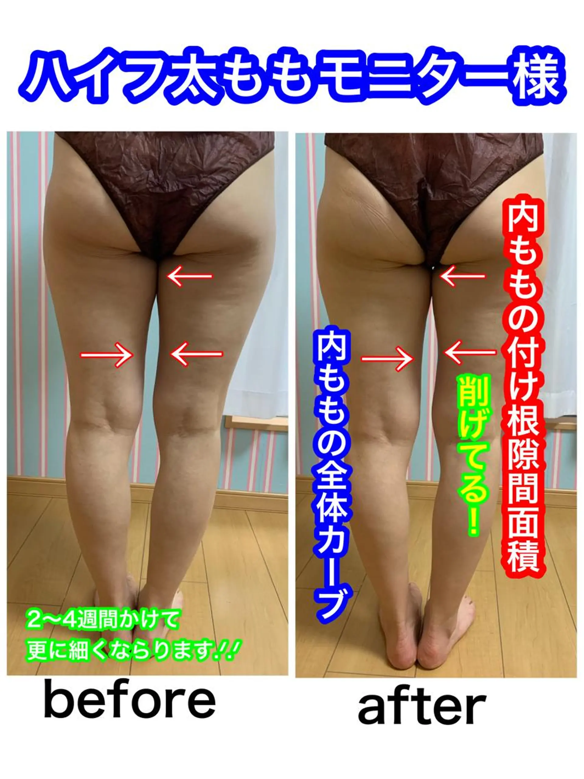 痩身/脱毛/ネイル HARUKAのエステ・リラクイメージ