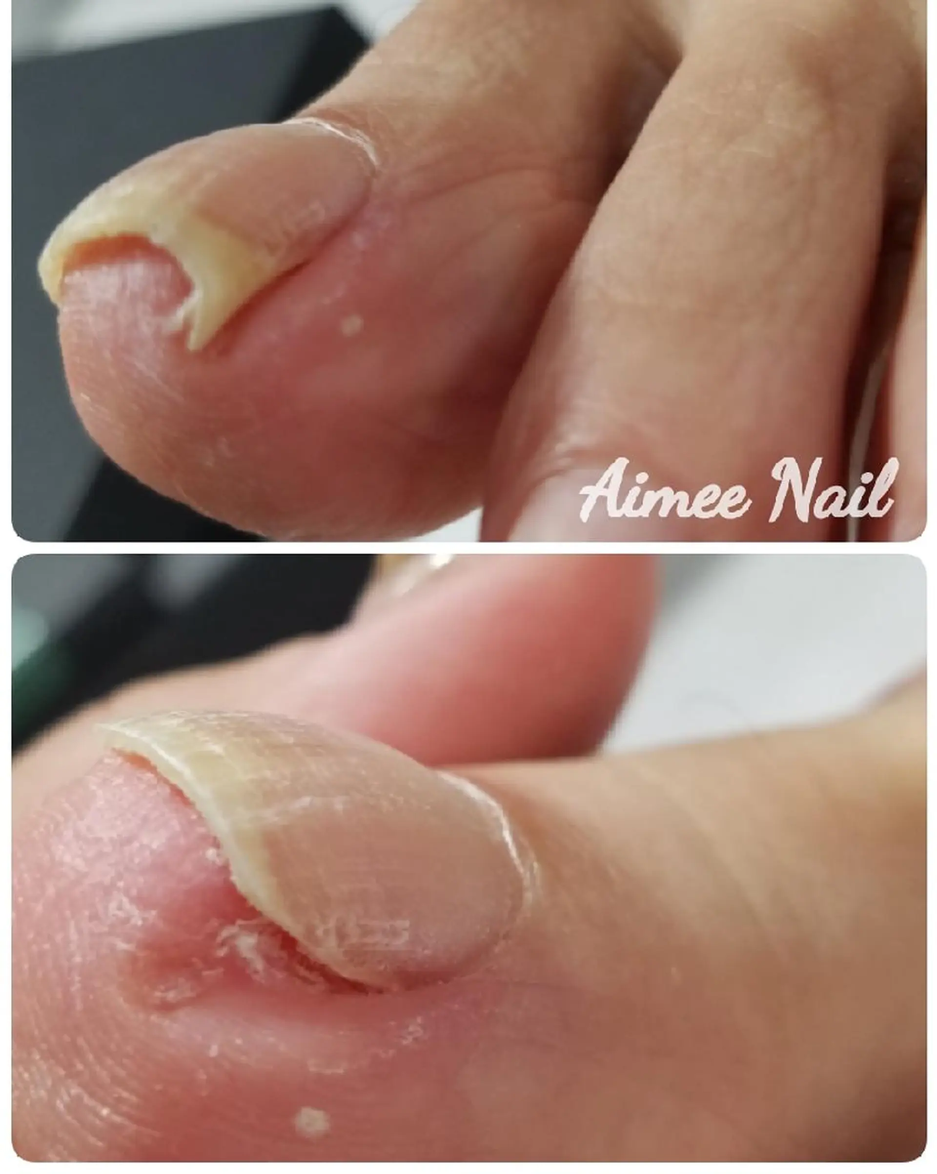 ネイル 齋藤 あゆみのネイルデザイン