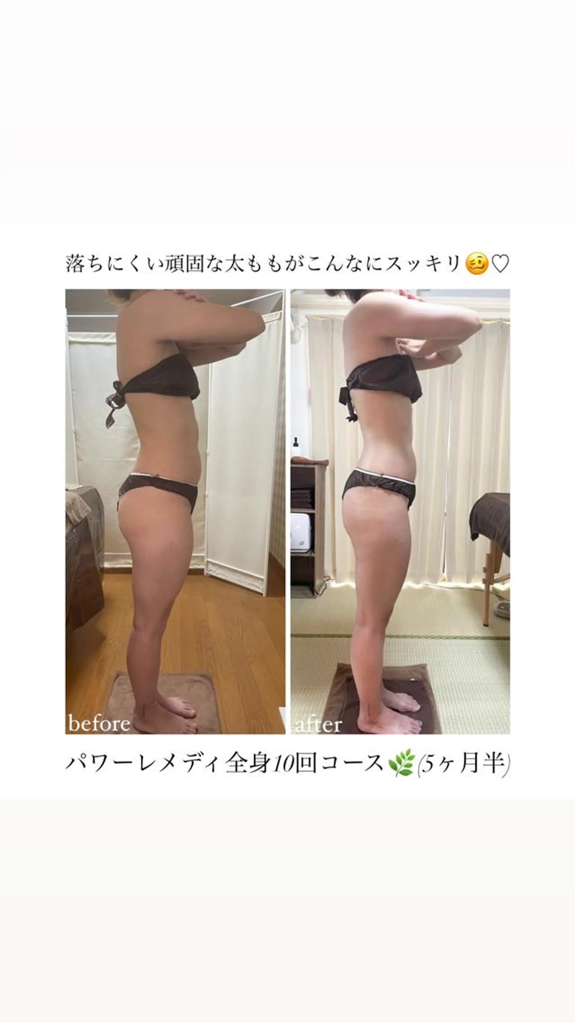 biloop所属・《痩身×疲労改善》 BILOOPのエステ・リラクイメージ