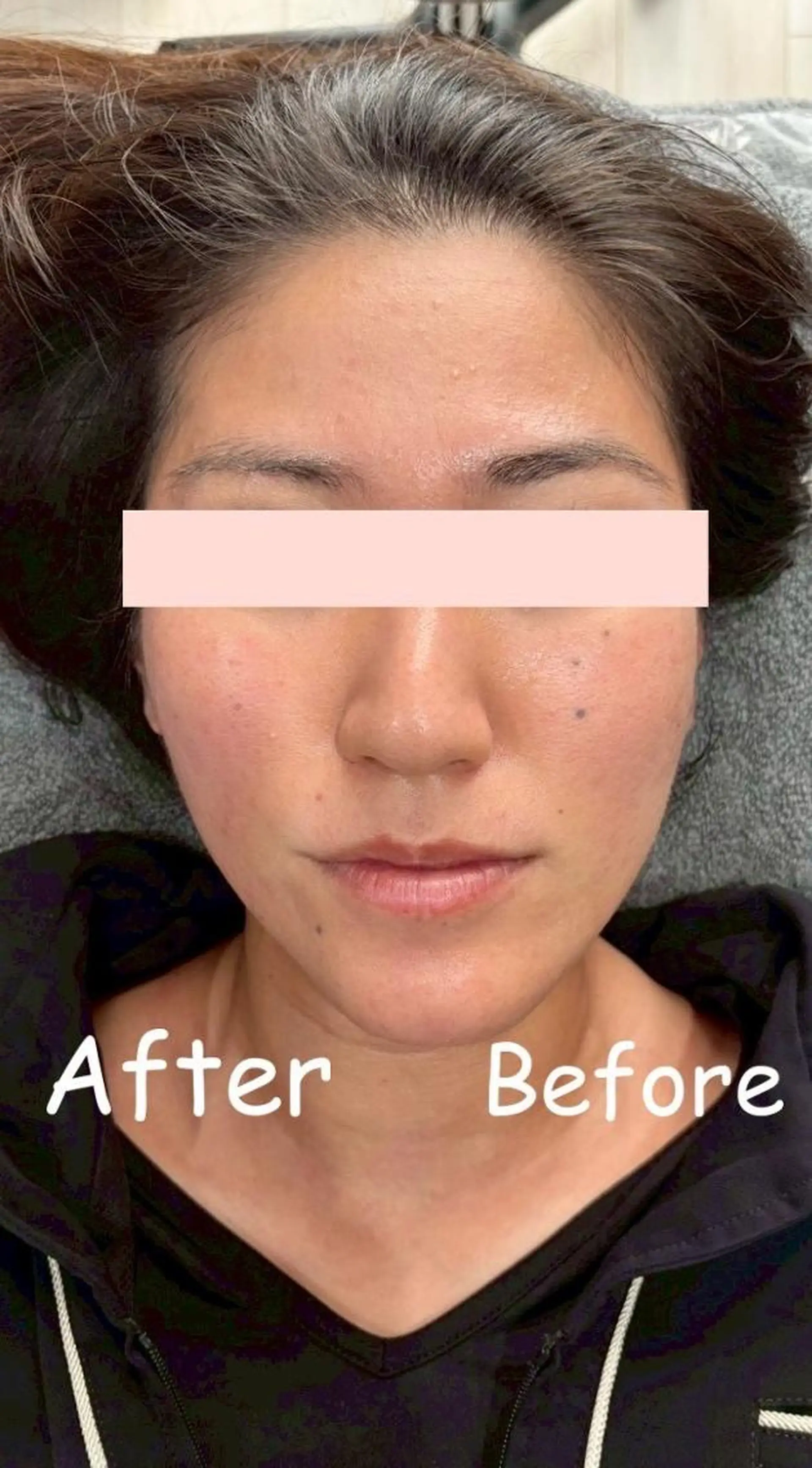 痩身Relives 金町店のその他イメージ